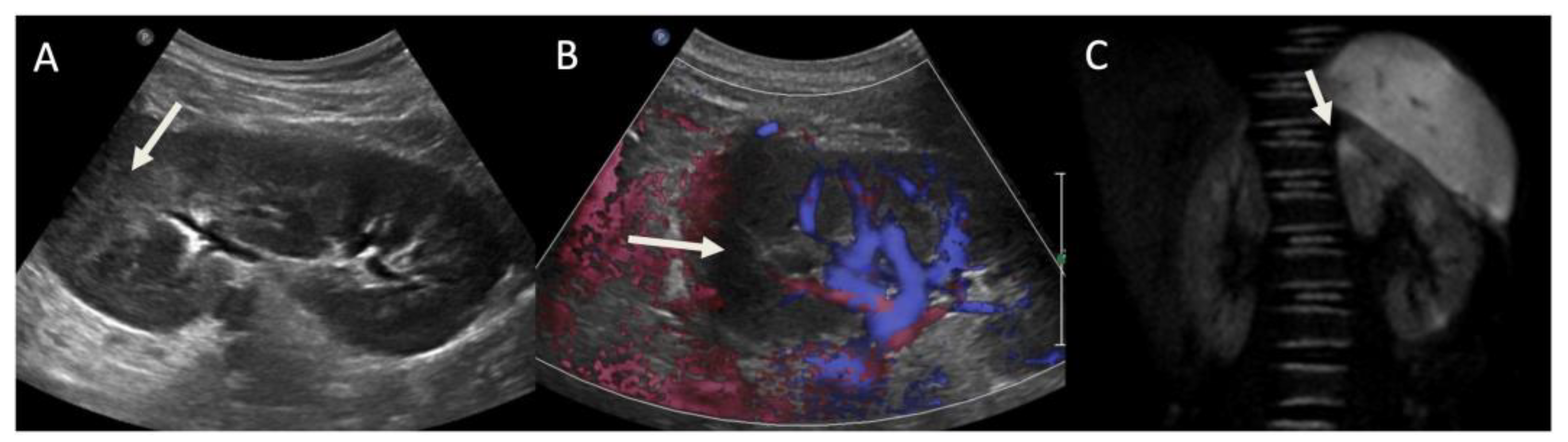 Jcm 10 02239 g004 Jcm 10 02239 g004