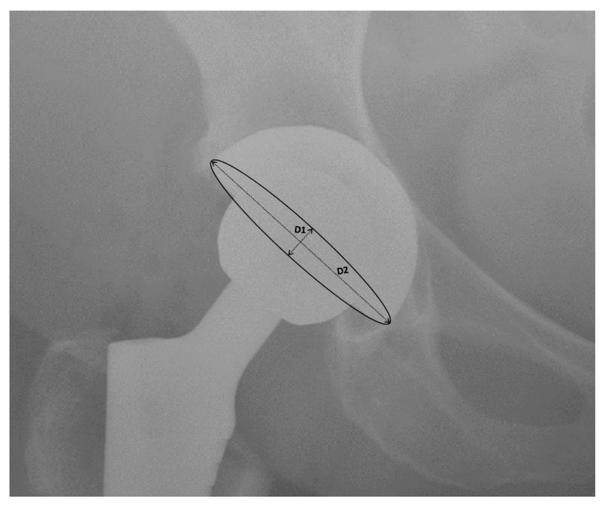 Jcm 10 02246 g004 Jcm 10 02246 g004