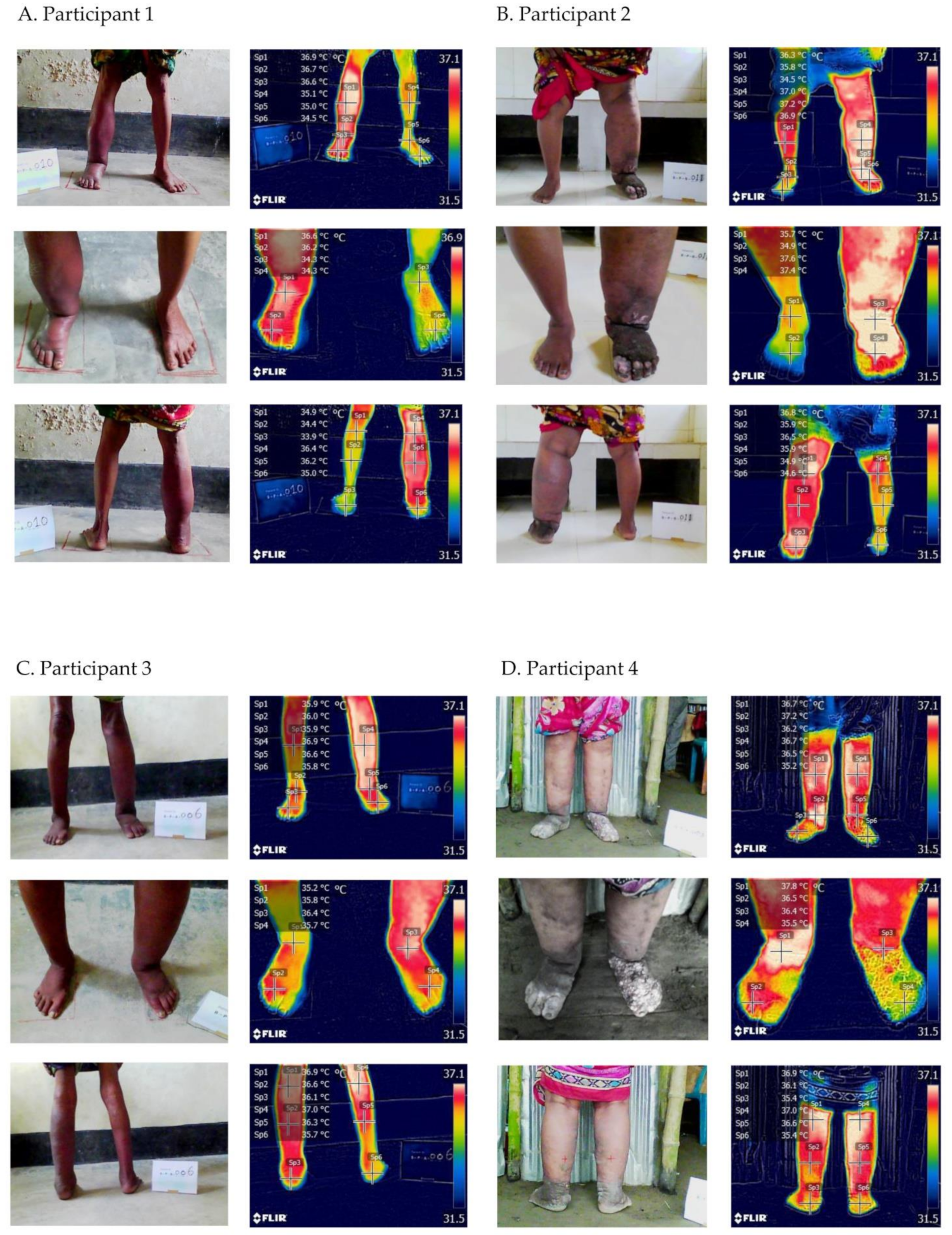 Jcm 10 02301 g002 Jcm 10 02301 g002