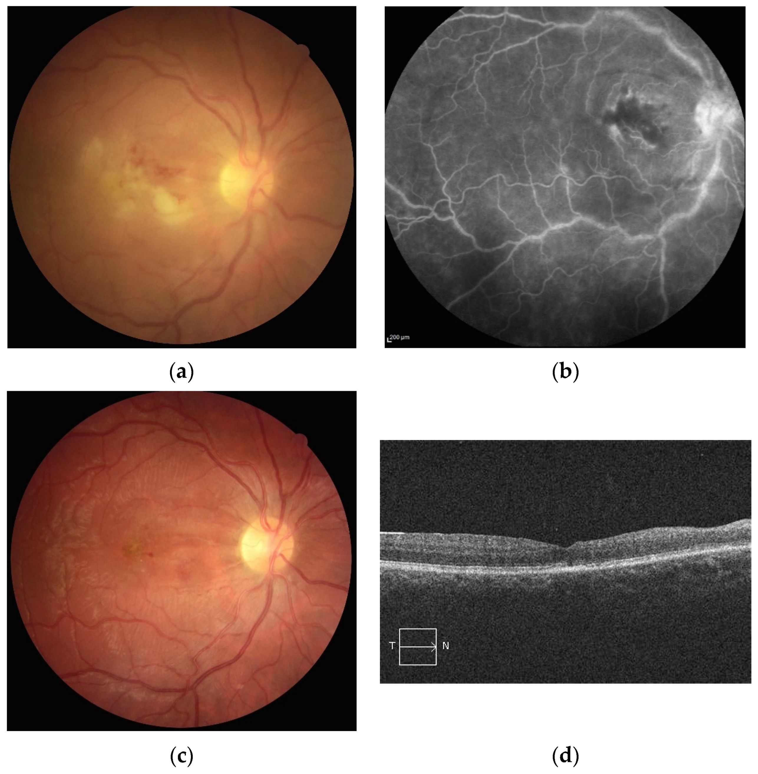 Jcm 10 02318 g001 Jcm 10 02318 g001