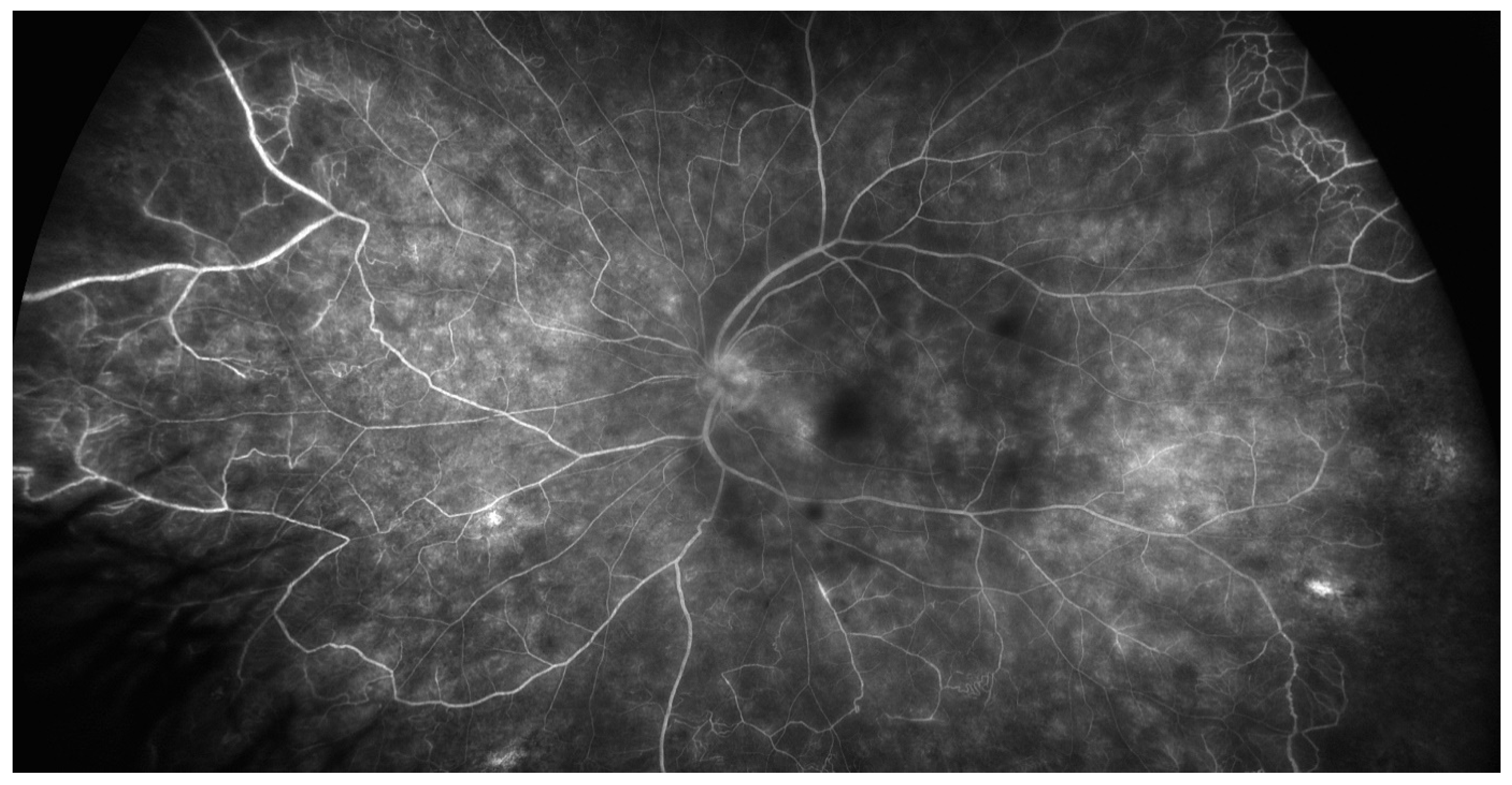 Jcm 10 02318 g002 Jcm 10 02318 g002