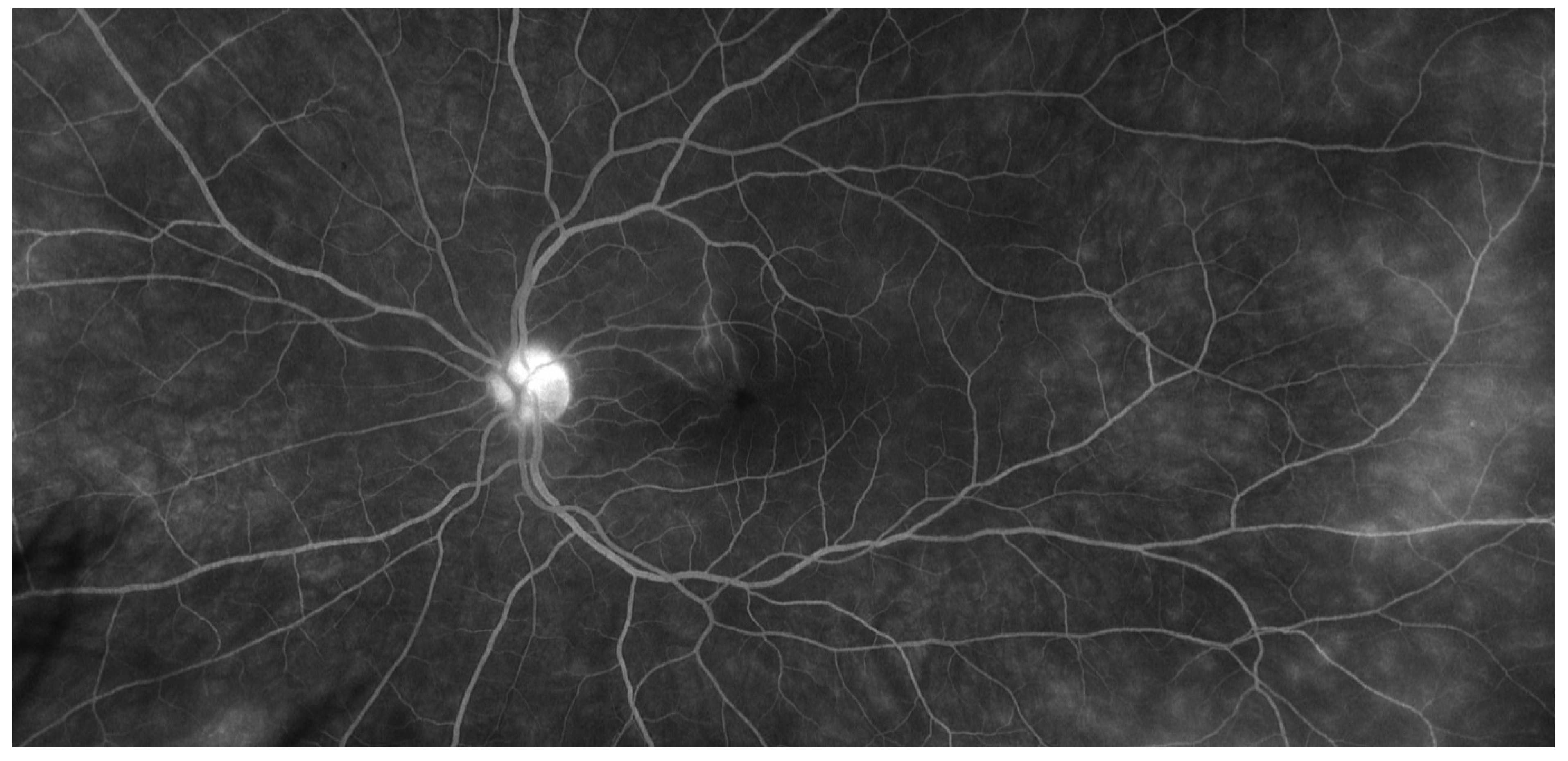 Jcm 10 02318 g003 Jcm 10 02318 g003