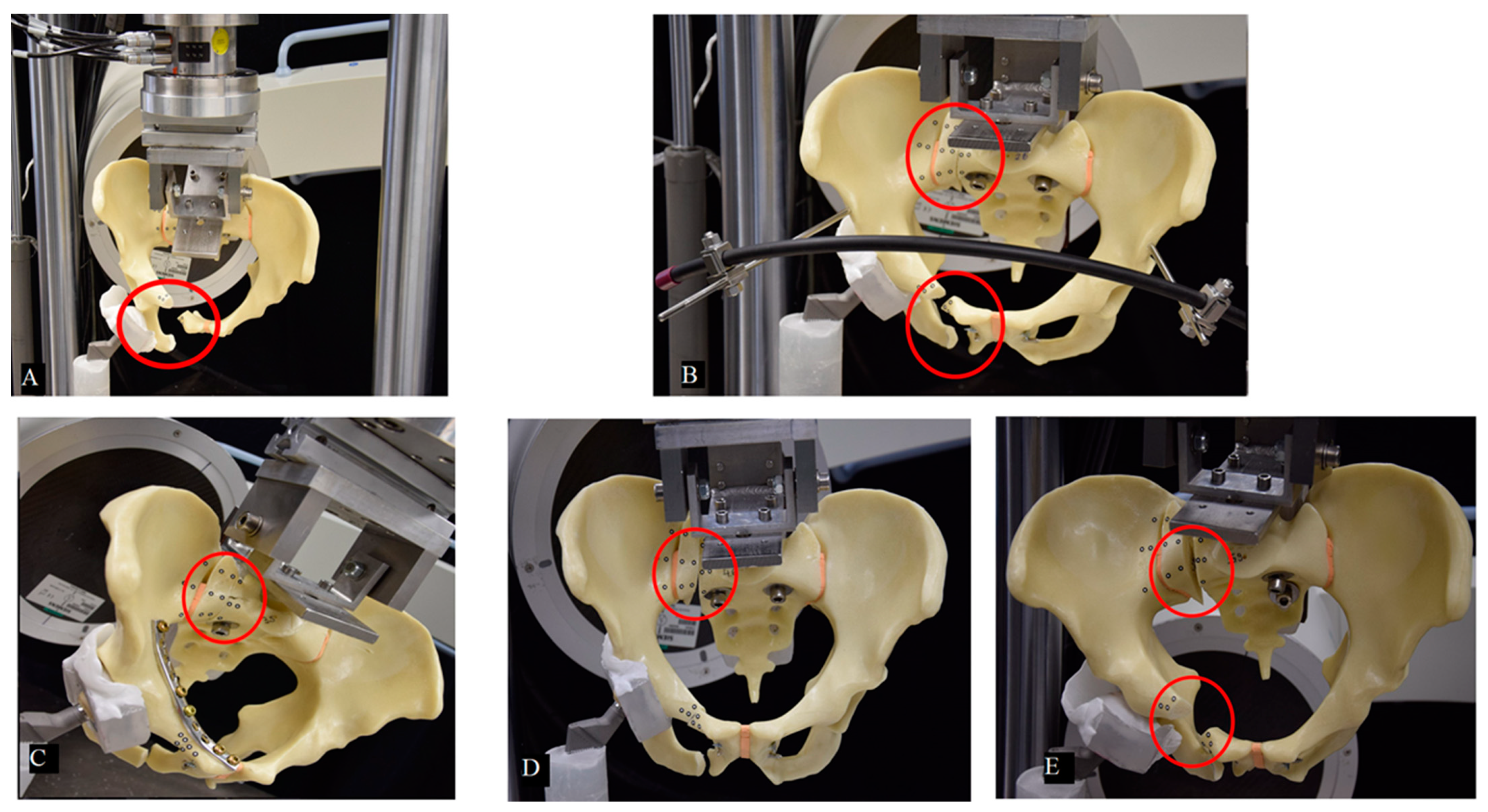 Jcm 10 02326 g007 Jcm 10 02326 g007