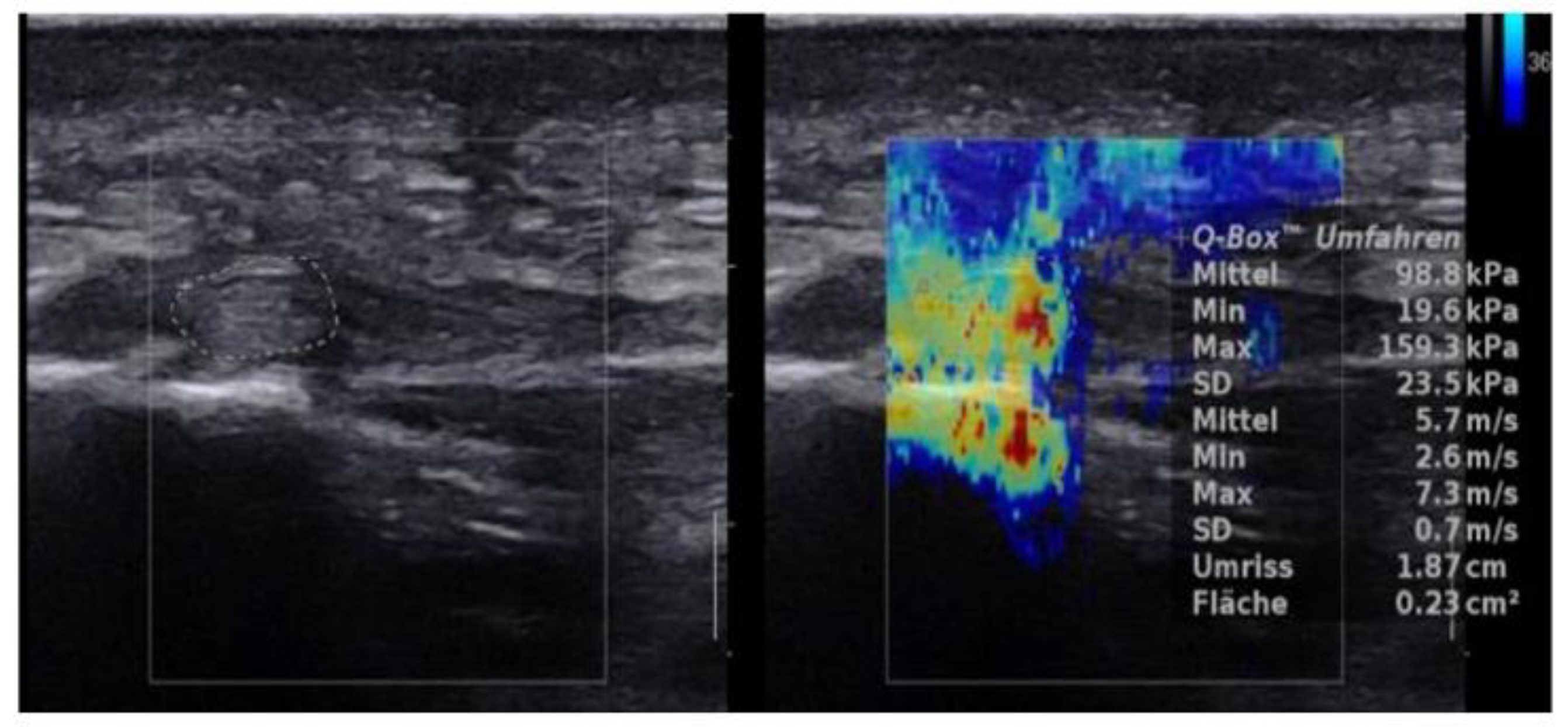 Jcm 10 02351 g002 Jcm 10 02351 g002