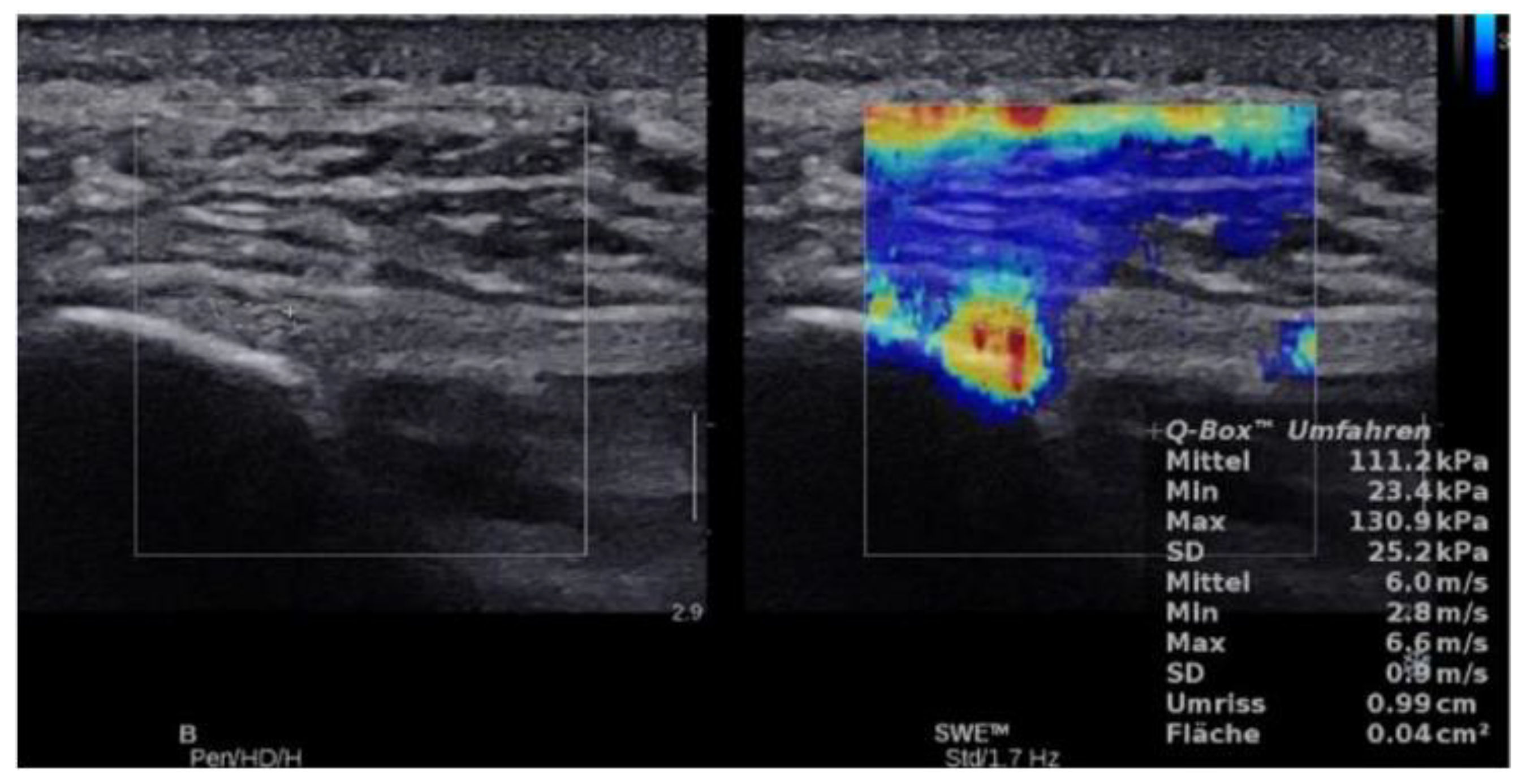 Jcm 10 02351 g003 Jcm 10 02351 g003