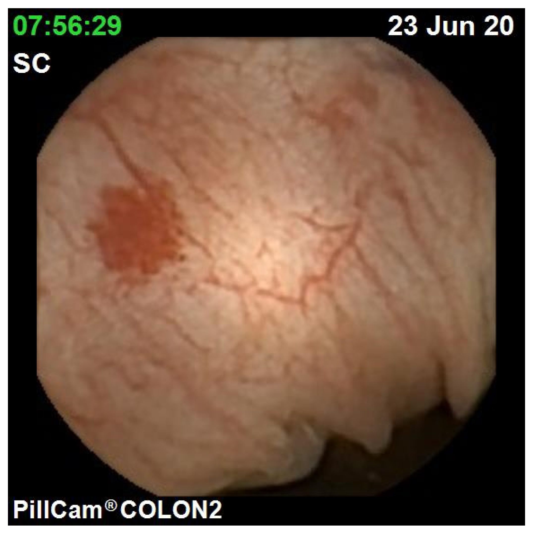 Jcm 10 02372 g002 Jcm 10 02372 g002