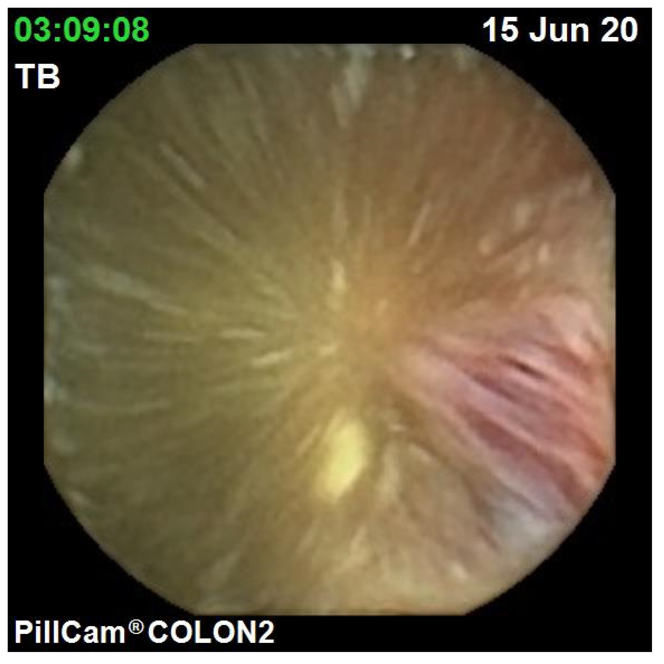 Jcm 10 02372 g003 Jcm 10 02372 g003