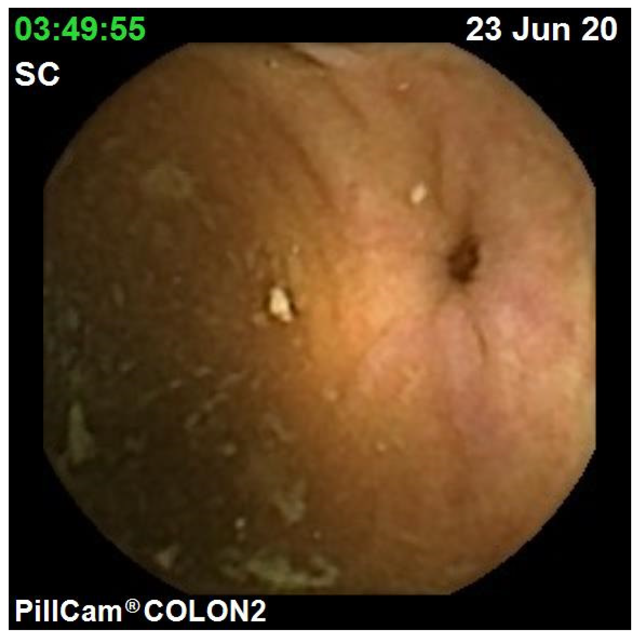 Jcm 10 02372 g004 Jcm 10 02372 g004