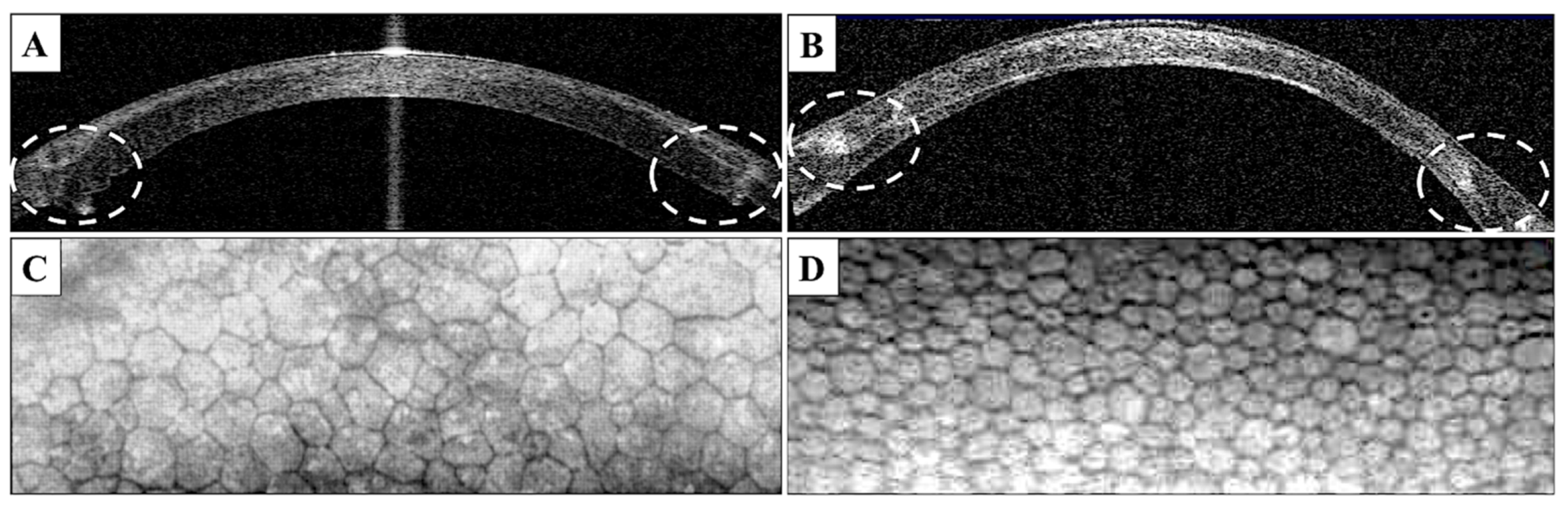 Jcm 10 02421 g004 Jcm 10 02421 g004
