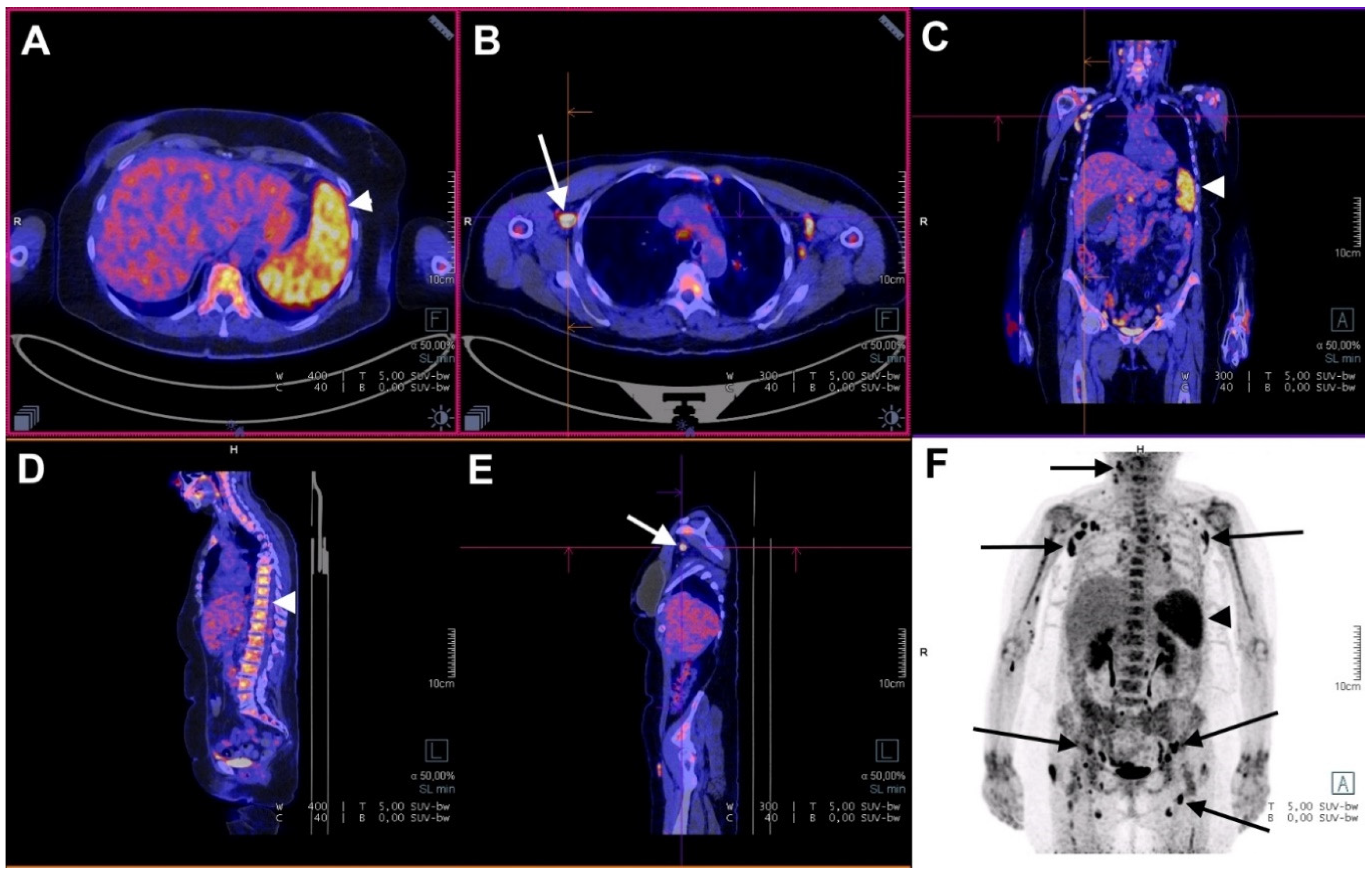Jcm 10 02489 g001 Jcm 10 02489 g001