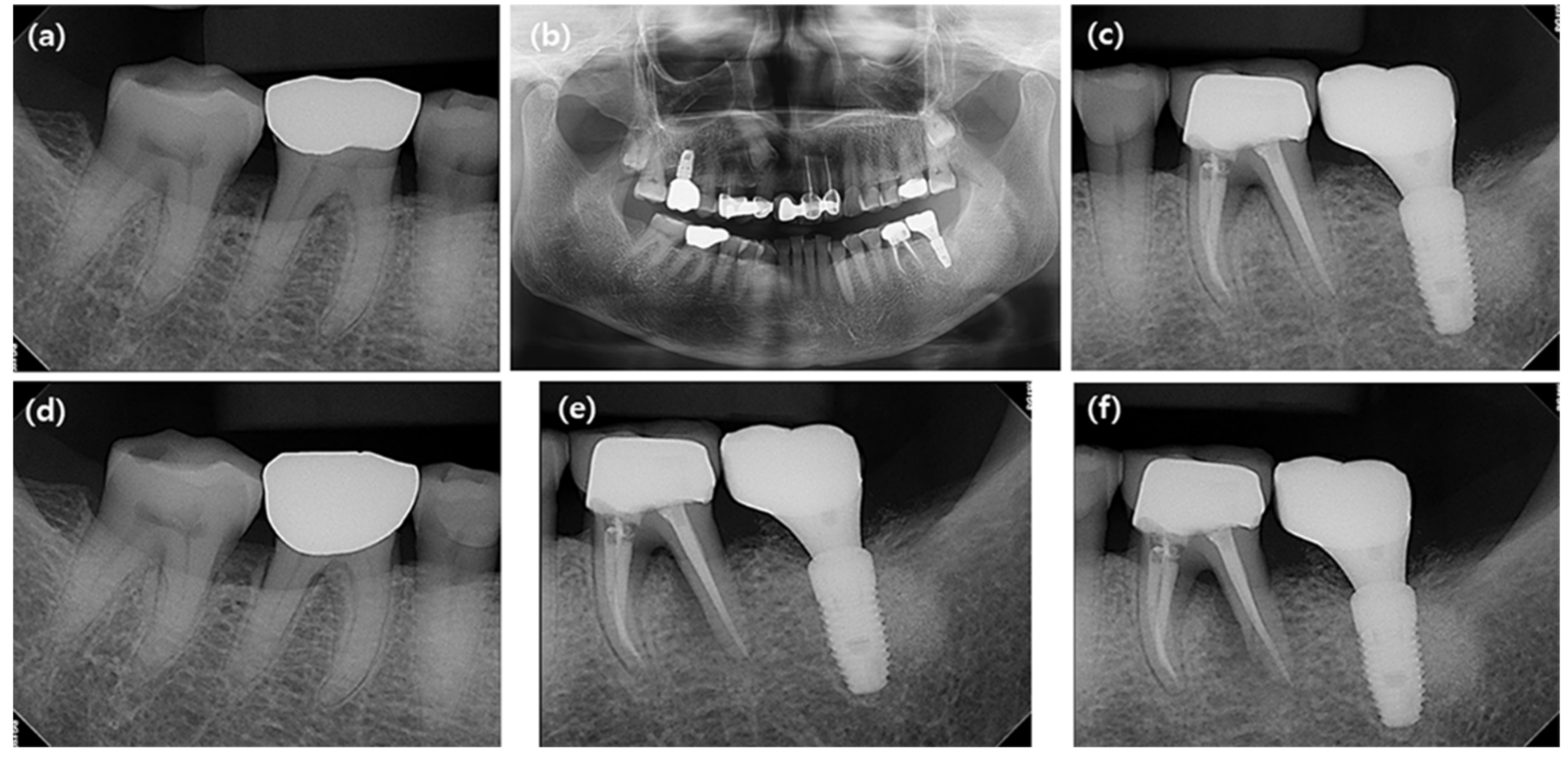 Jcm 10 02543 g002 Jcm 10 02543 g002