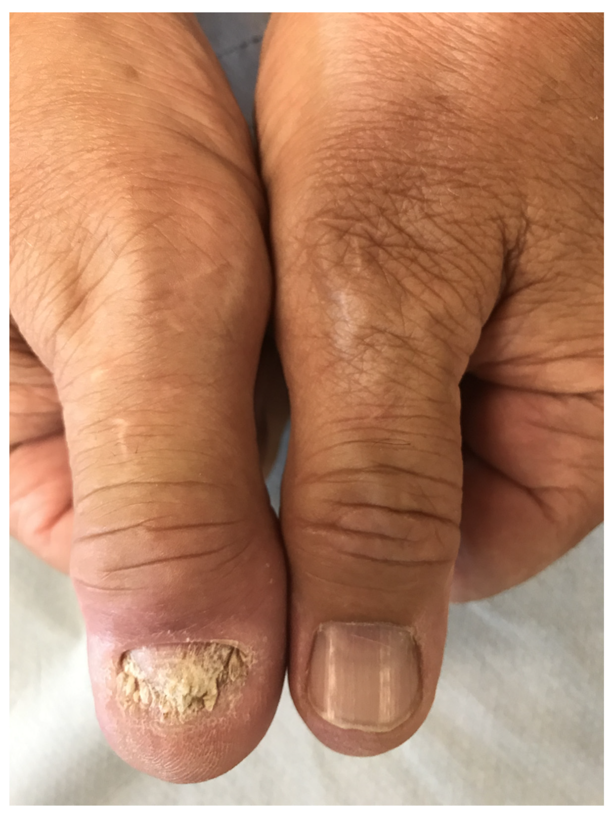 Jcm 10 02604 g001 Jcm 10 02604 g001