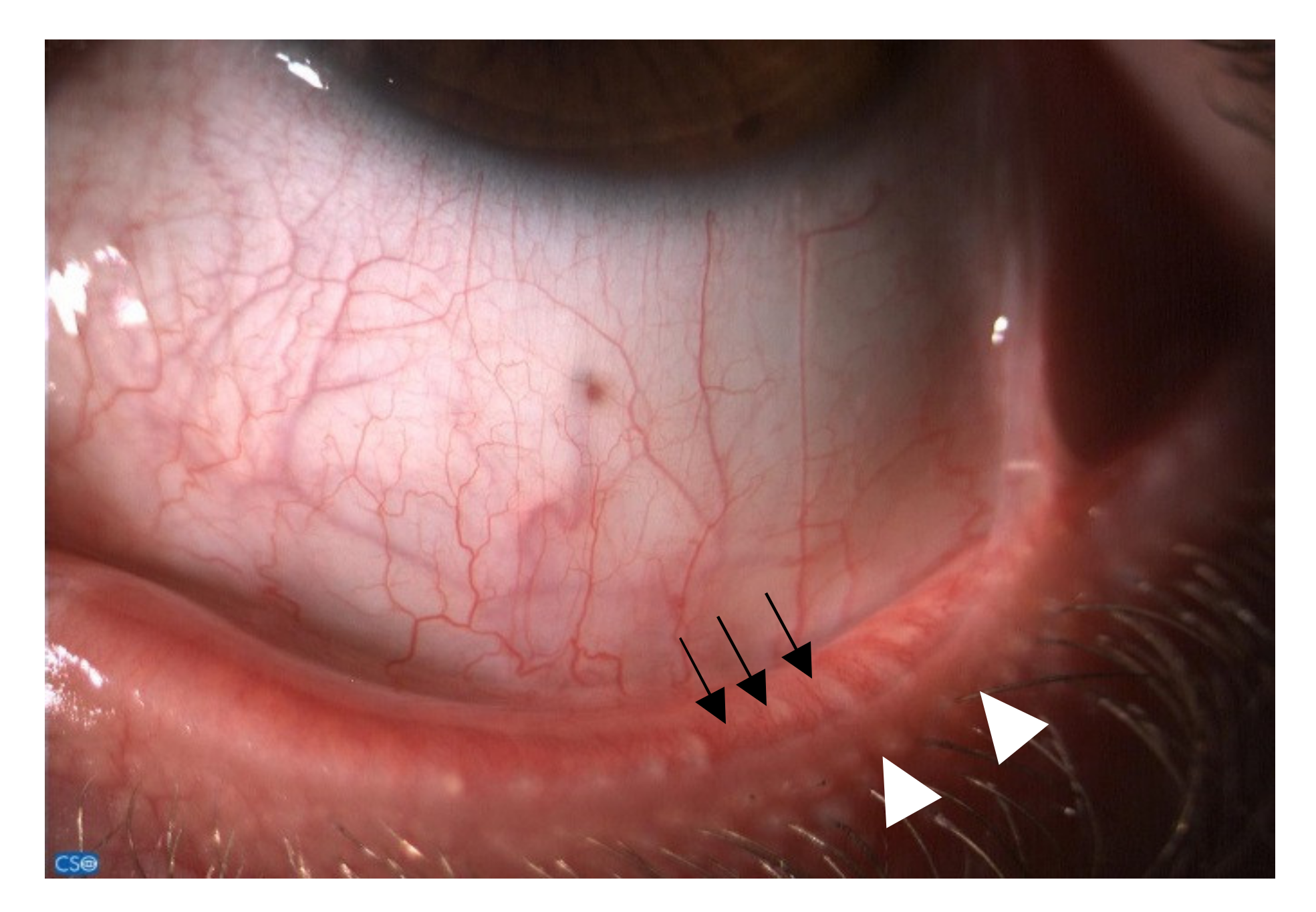 Jcm 10 02620 g001 Jcm 10 02620 g001