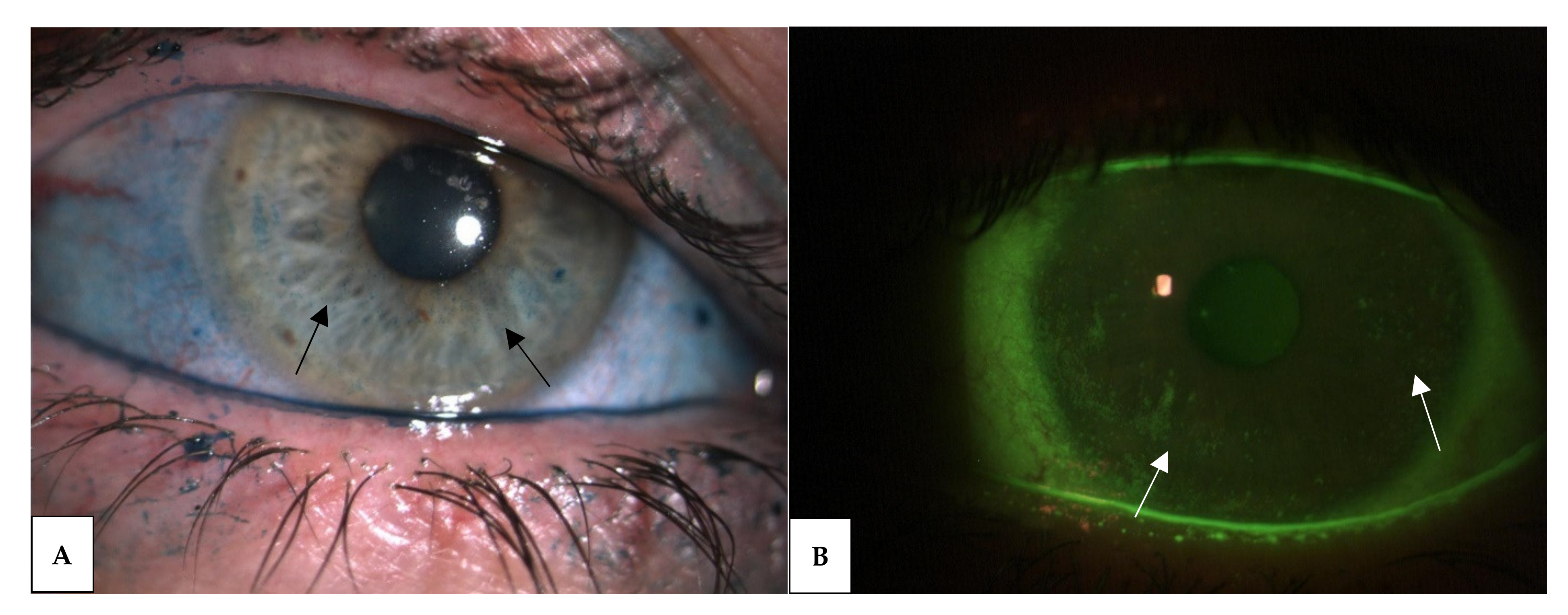 Jcm 10 02620 g003 Jcm 10 02620 g003