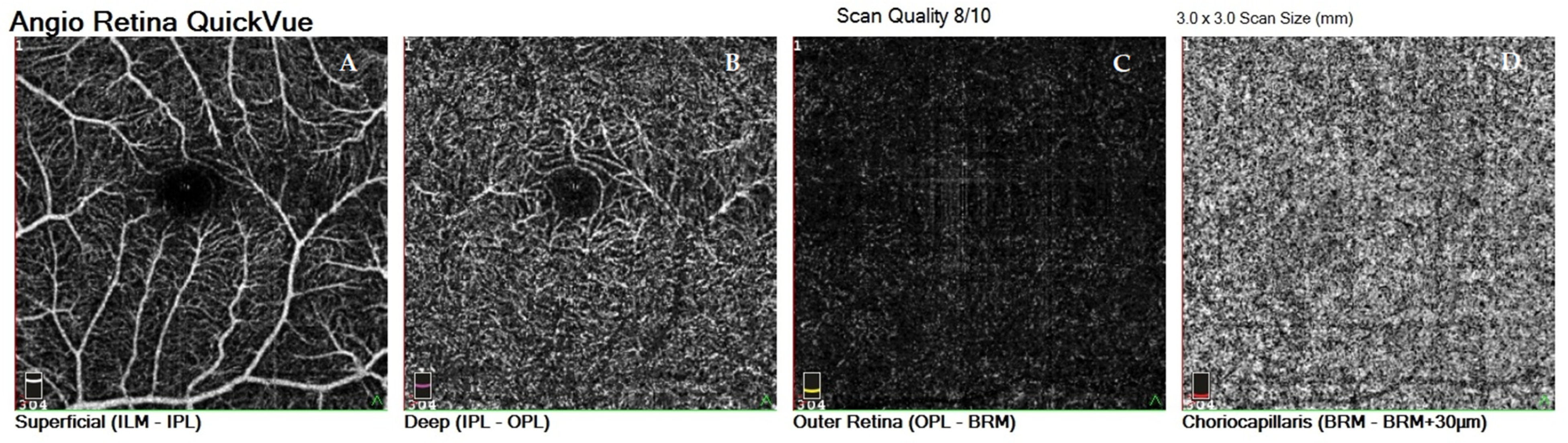 Jcm 10 02659 g001 Jcm 10 02659 g001