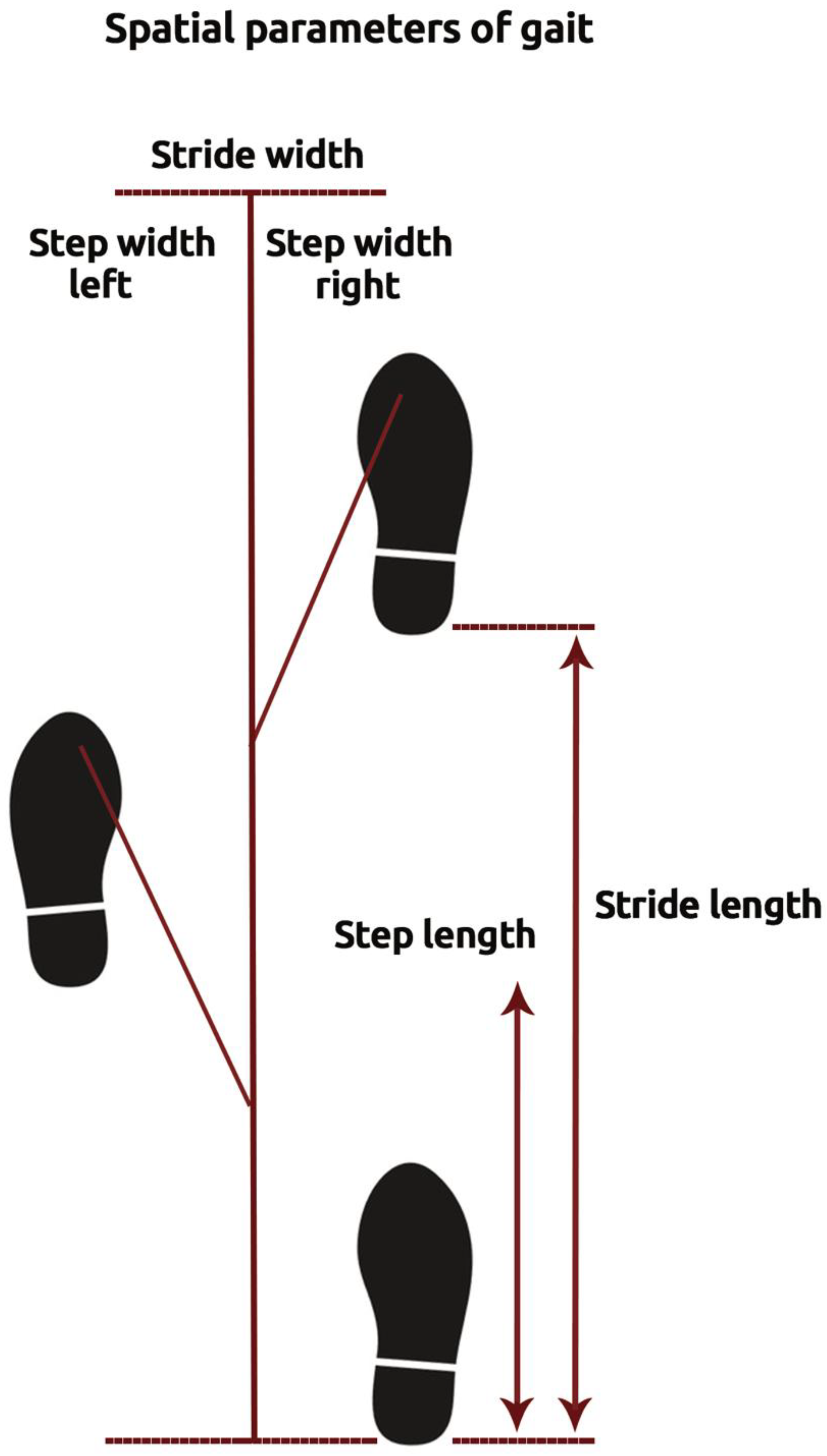 JCM Free FullText Stride Length Predicts Adverse Clinical Events