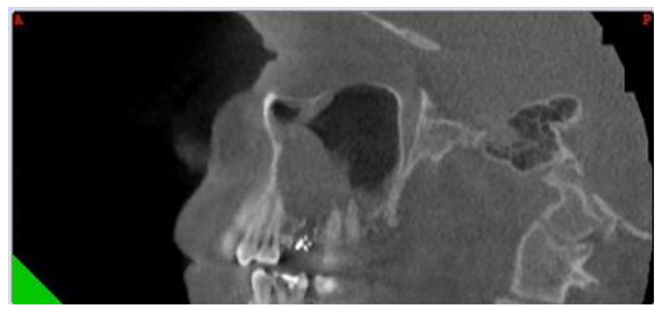 Jcm 10 02712 g003 Jcm 10 02712 g003