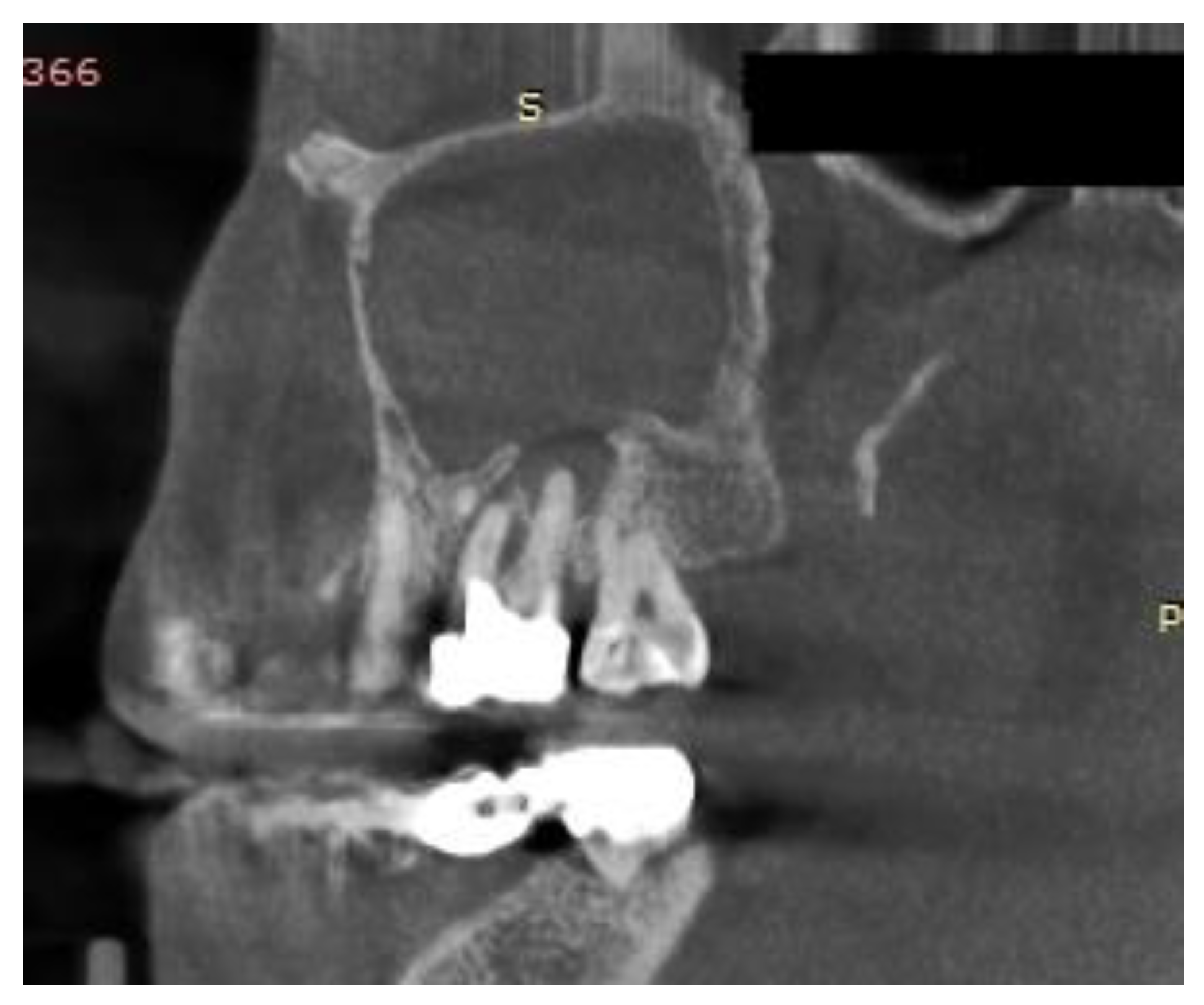 Jcm 10 02712 g004 Jcm 10 02712 g004