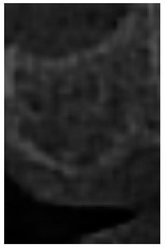 Jcm 10 02849 g003 550