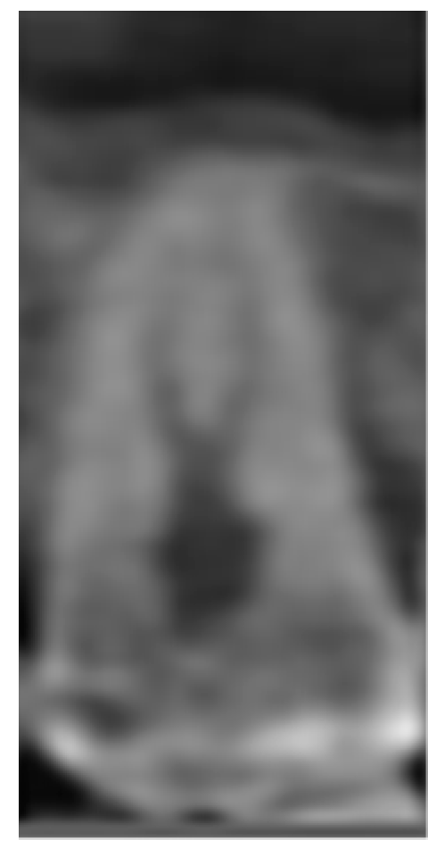 Jcm 10 02849 g004 550