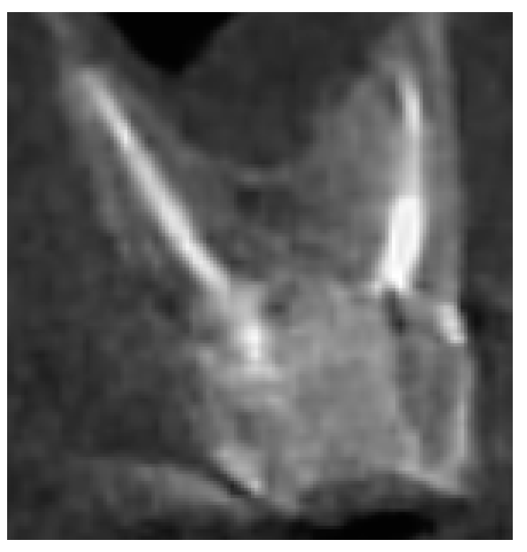 Jcm 10 02849 g005 550