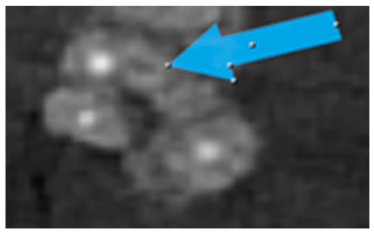 Jcm 10 02849 g006 550