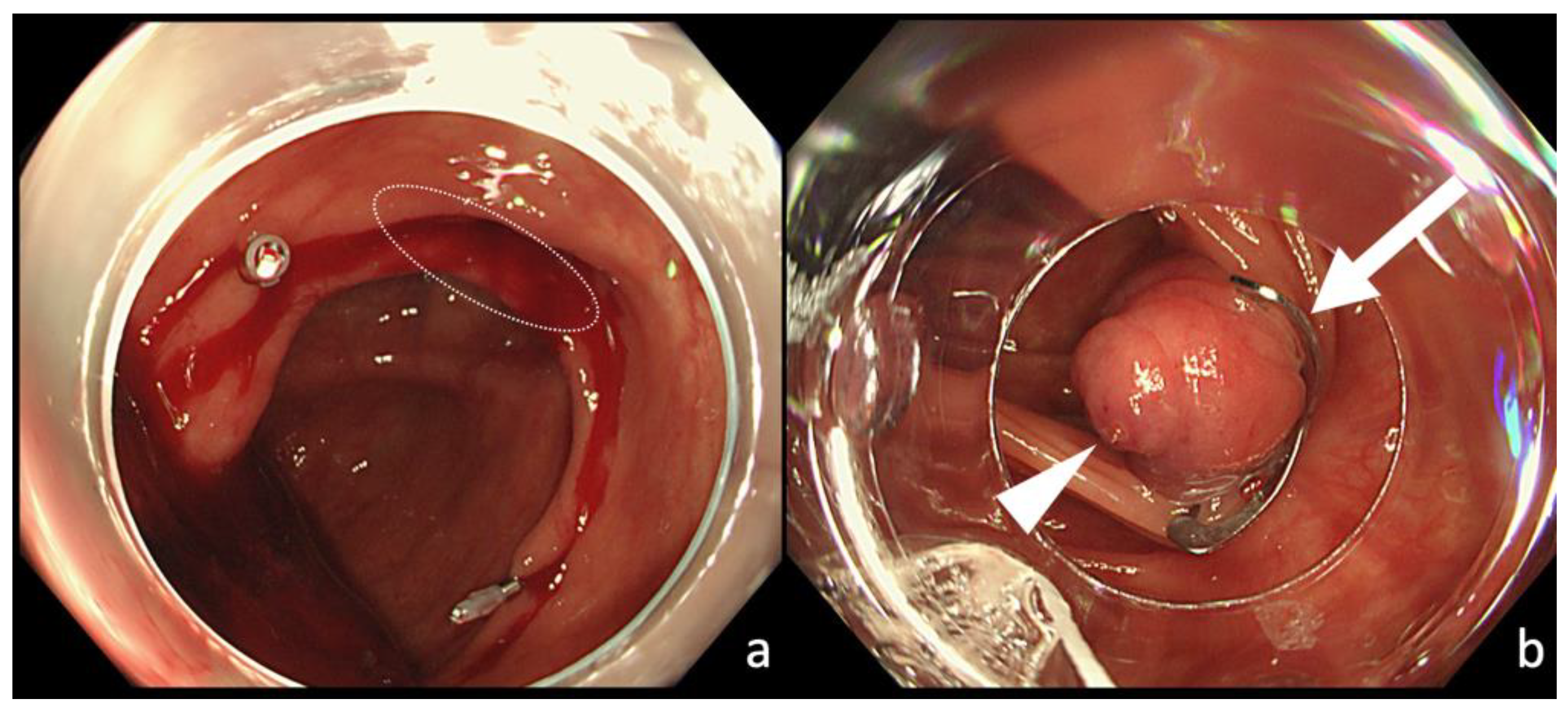 Jcm 10 02891 g002 550