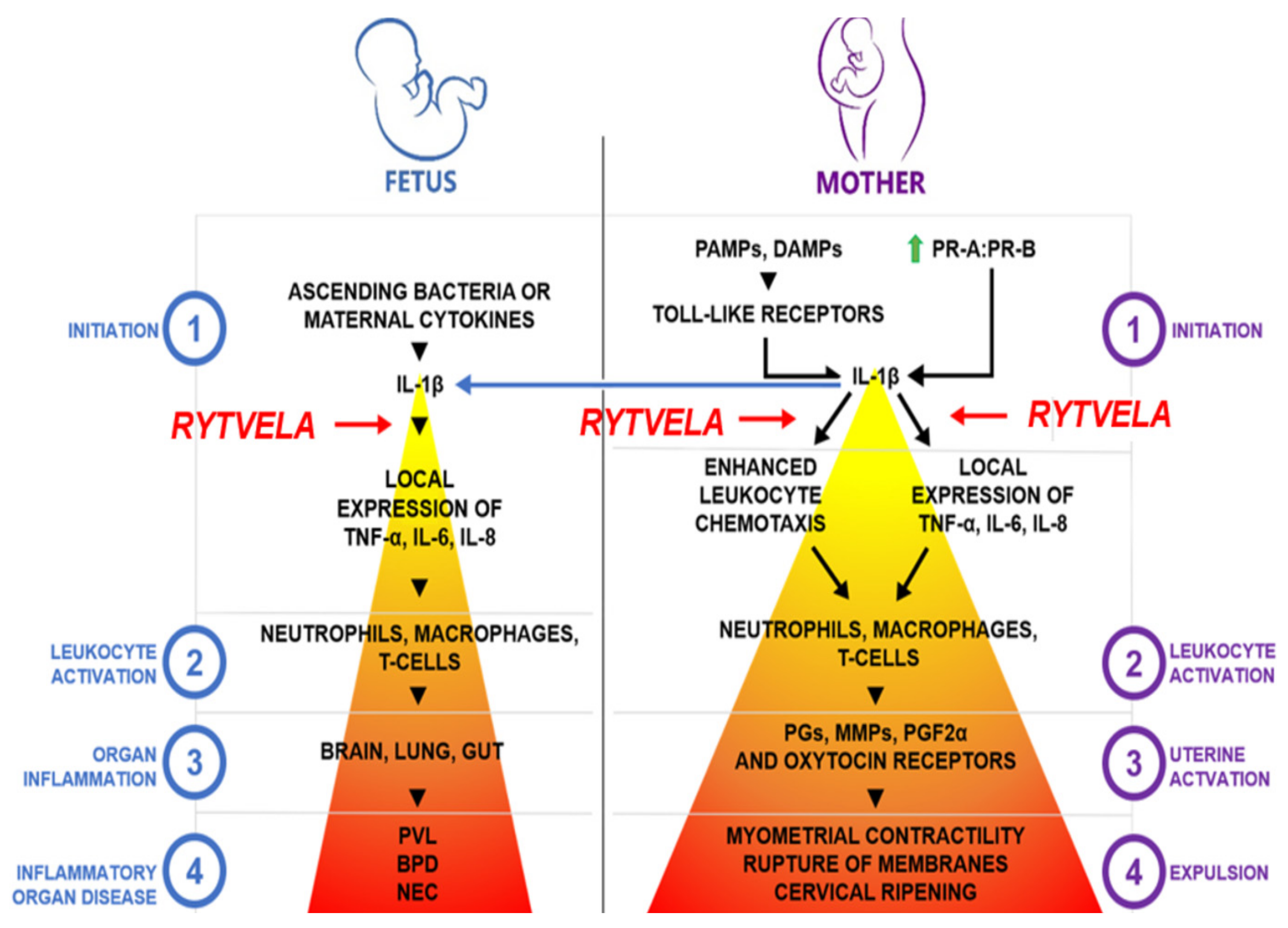 JCM Free FullText Landscape of Preterm Birth Therapeutics and a