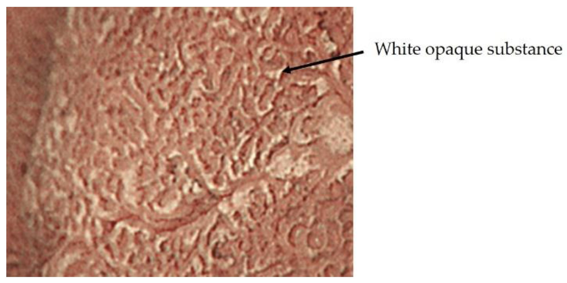 Jcm 10 02918 g004 550