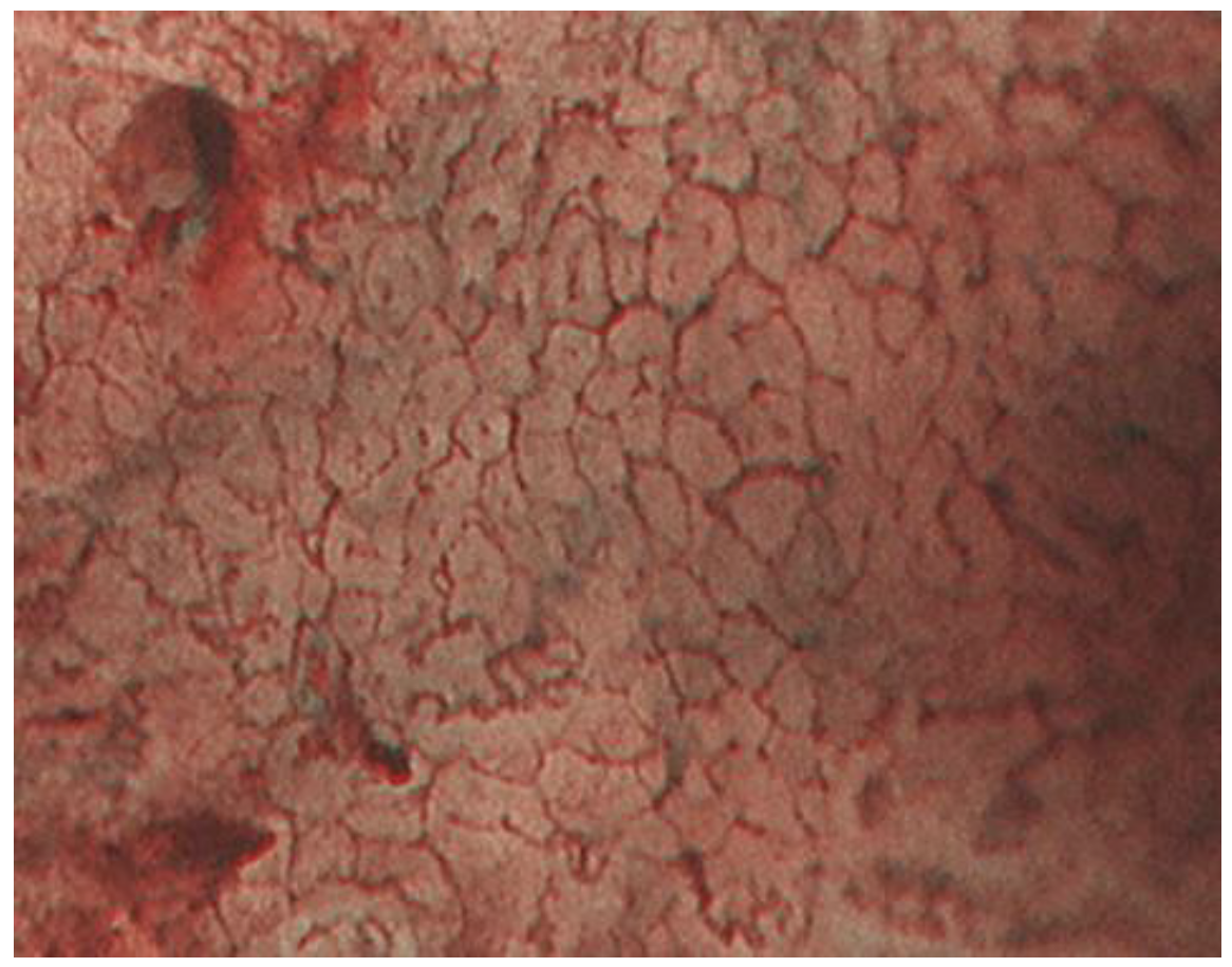 Jcm 10 02918 g007 550