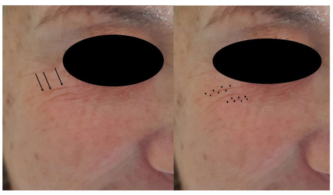 Jcm 10 03074 g001 550