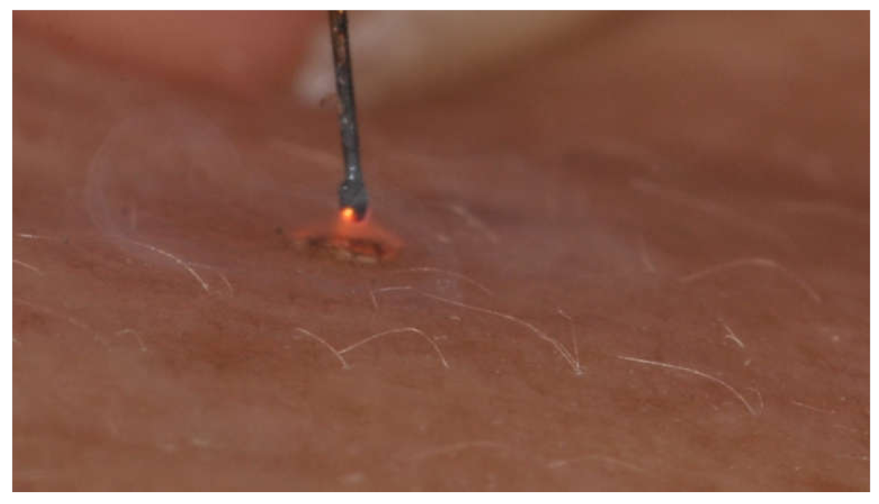 Jcm 10 03074 g002 550