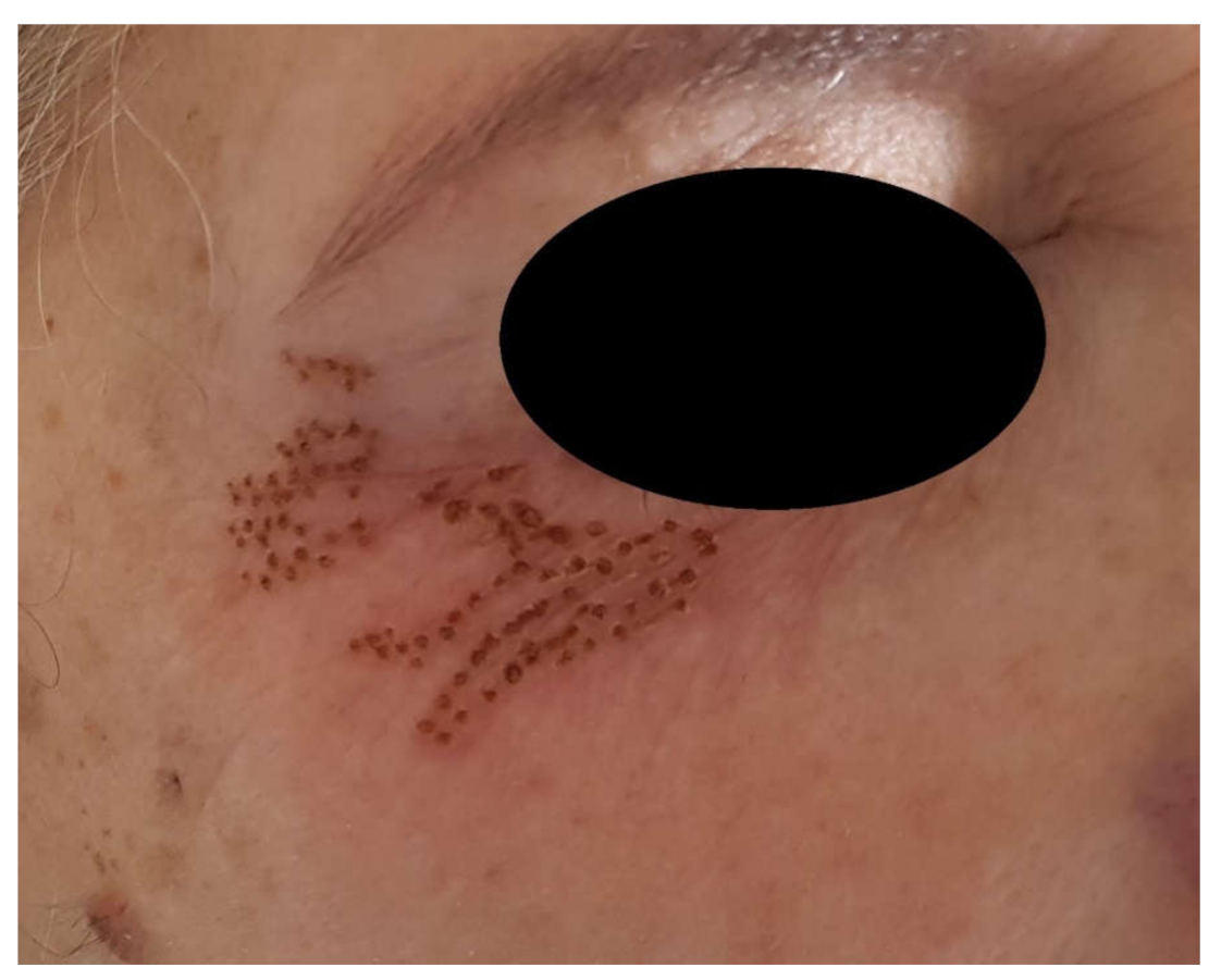 Jcm 10 03074 g003 550