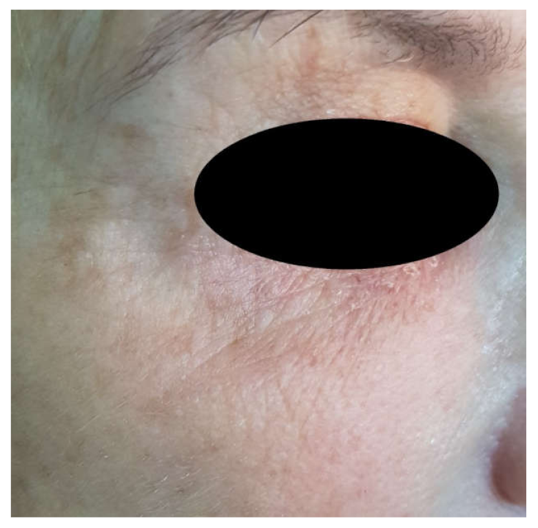 Jcm 10 03074 g004 550