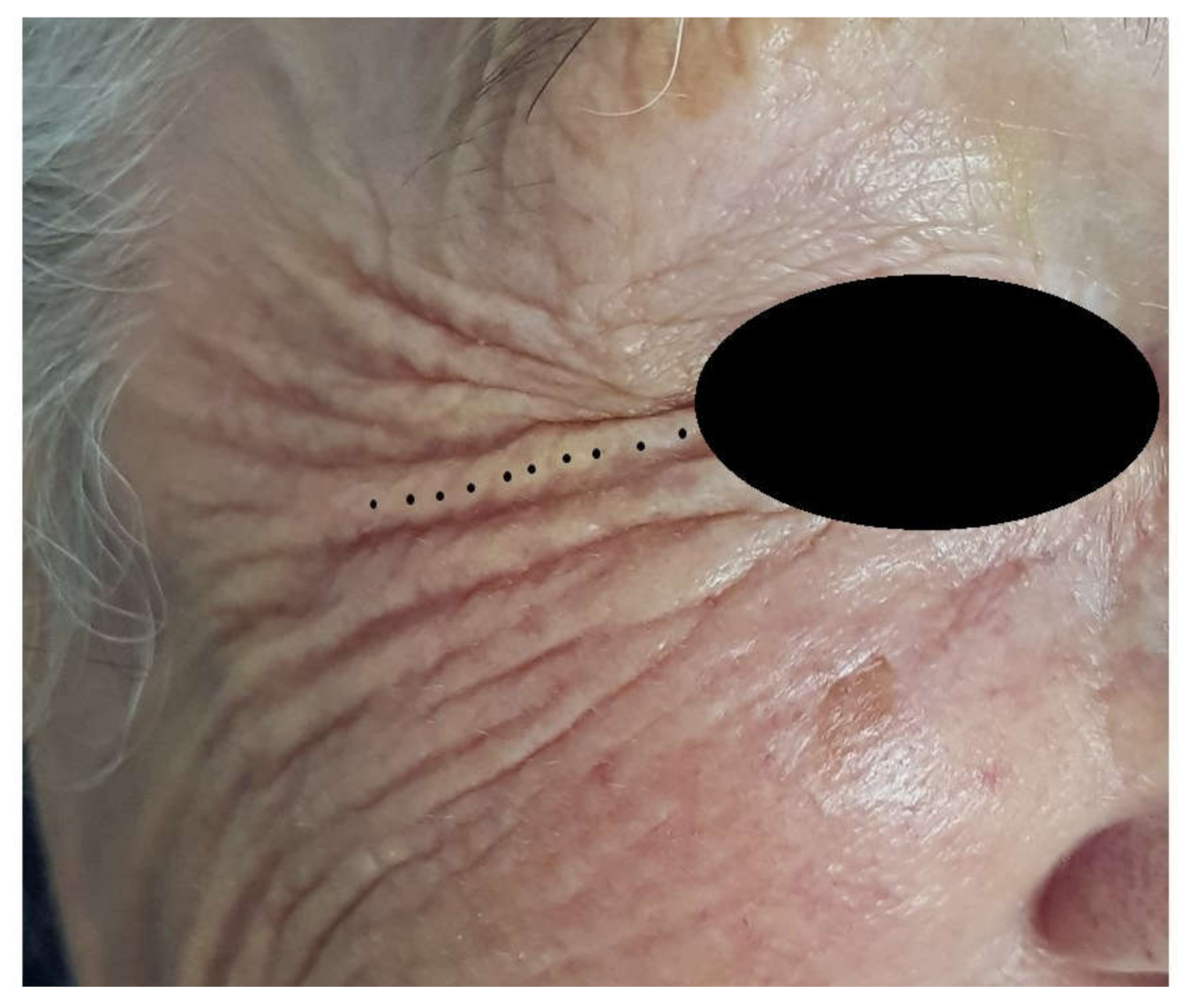 Jcm 10 03074 g005 550