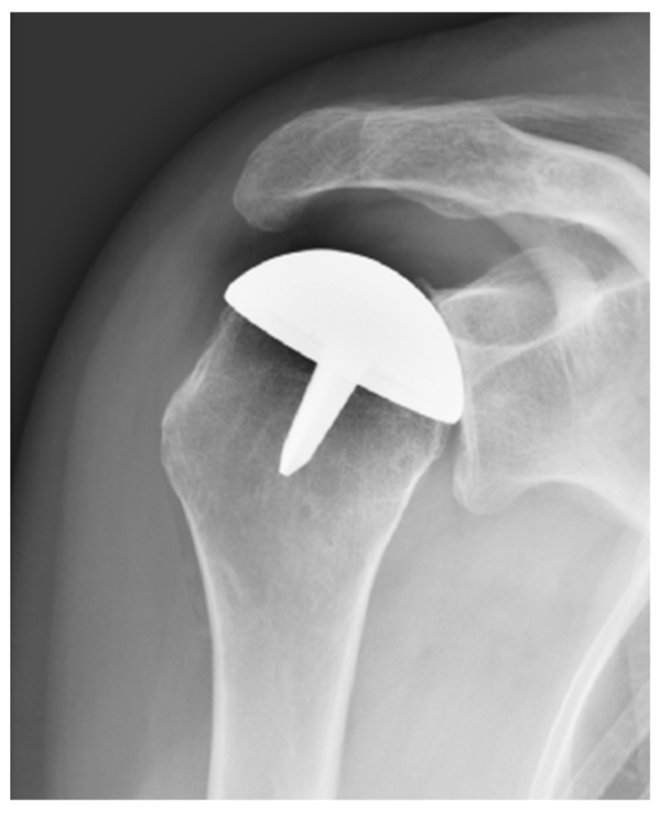 Jcm 10 03081 g002 Jcm 10 03081 g002