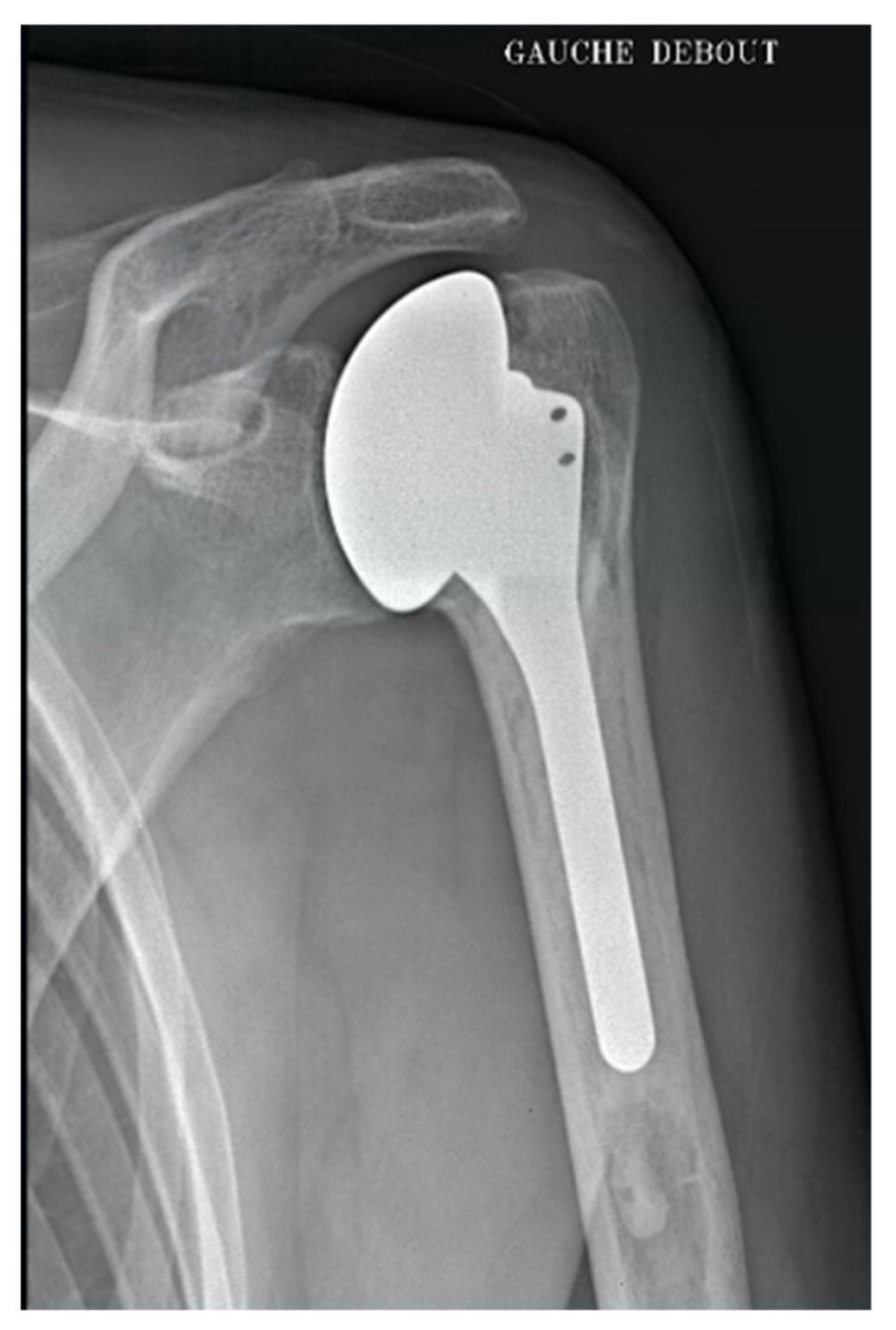 Jcm 10 03081 g003 Jcm 10 03081 g003