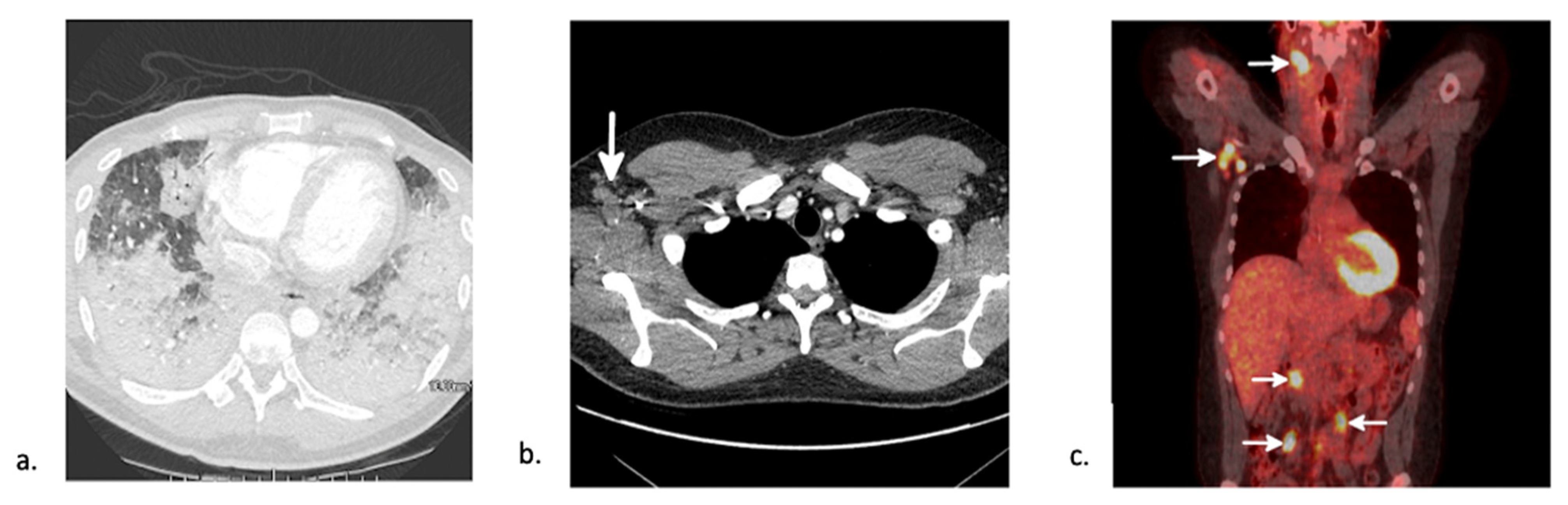 Jcm 10 03227 g003 Jcm 10 03227 g003