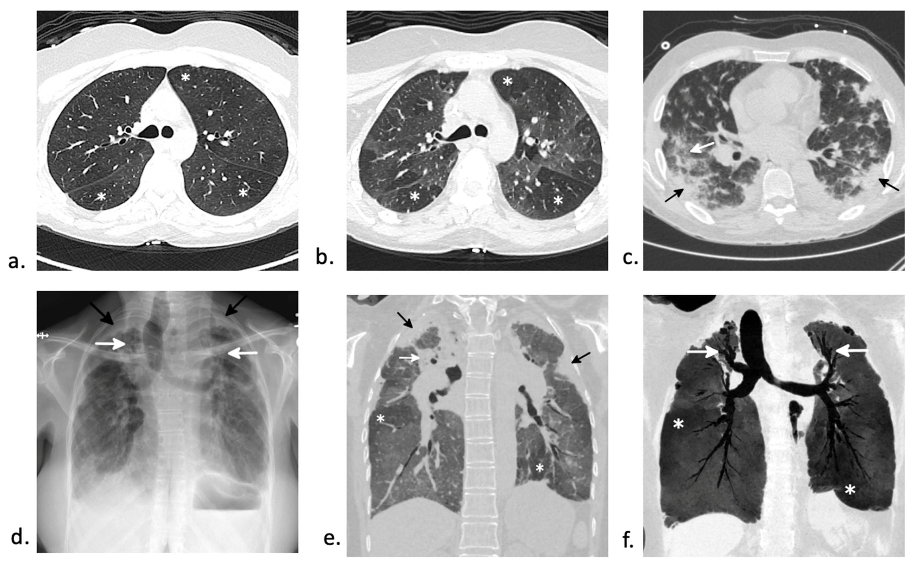 Jcm 10 03227 g004 Jcm 10 03227 g004