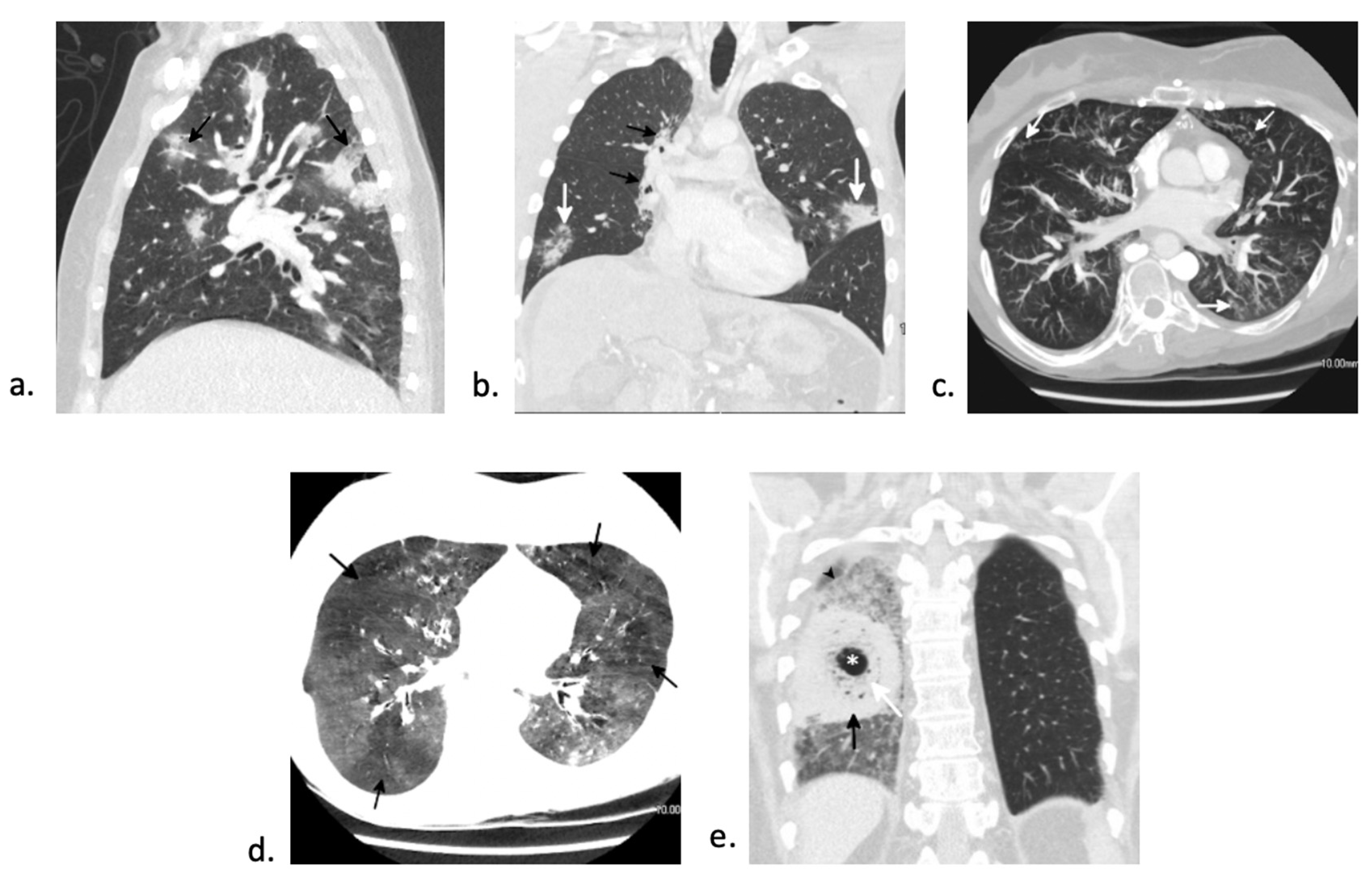 Jcm 10 03227 g005 Jcm 10 03227 g005