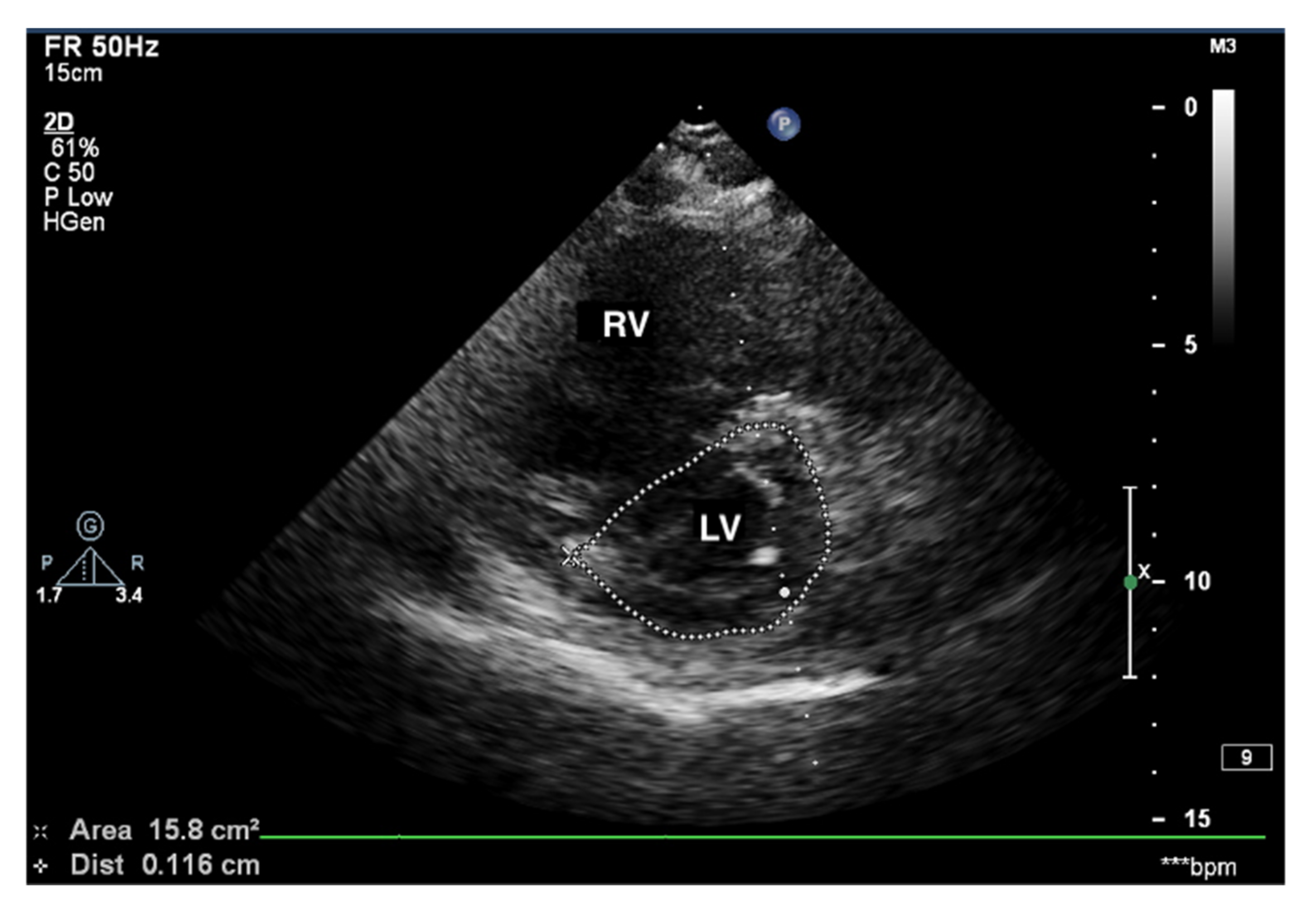 JCM | Free Full-Text | Echocardiography in Pulmonary Arterial ...
