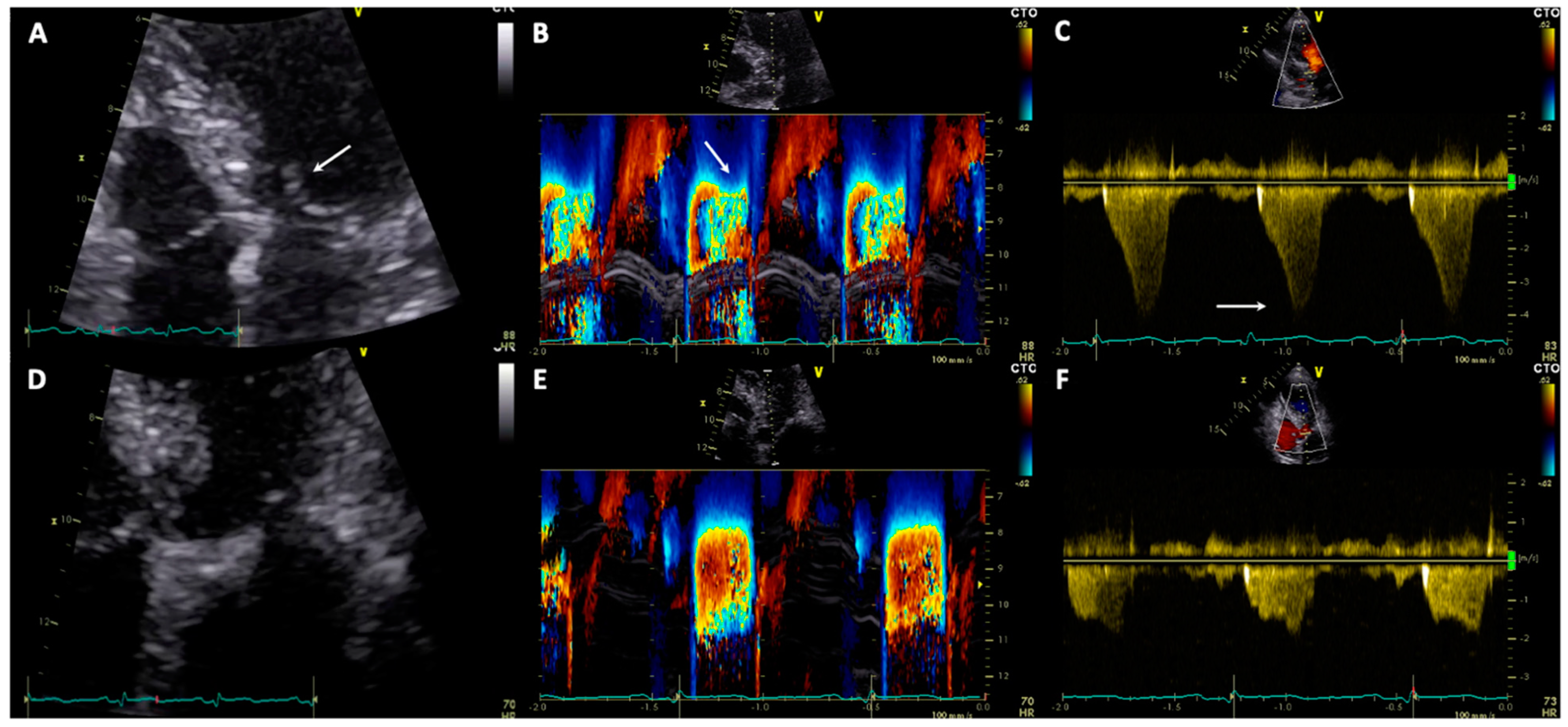 Jcm 10 03235 g002 Jcm 10 03235 g002