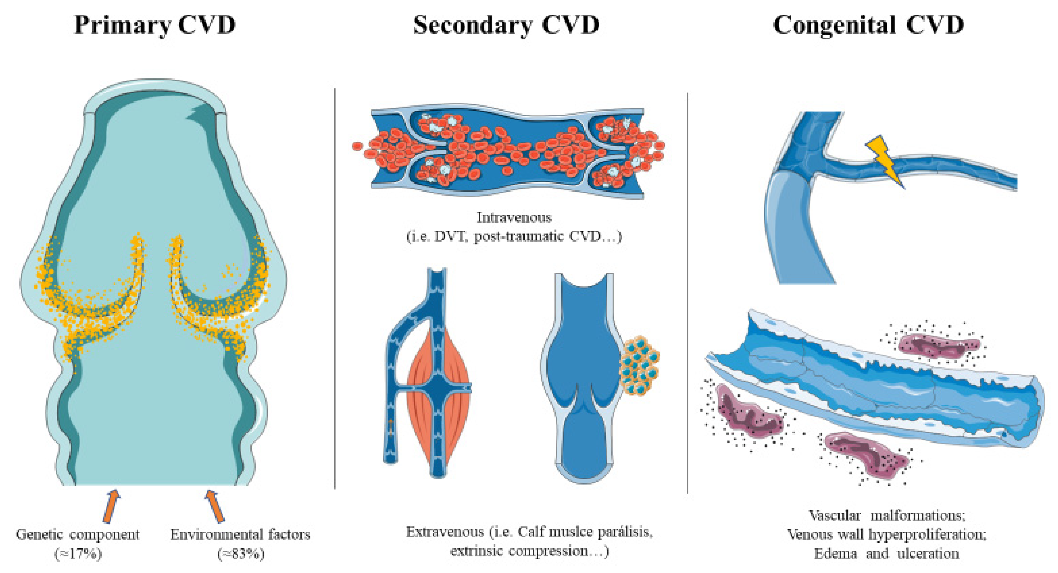 Chronic Venous Insufficiency - Cape Town Vascular