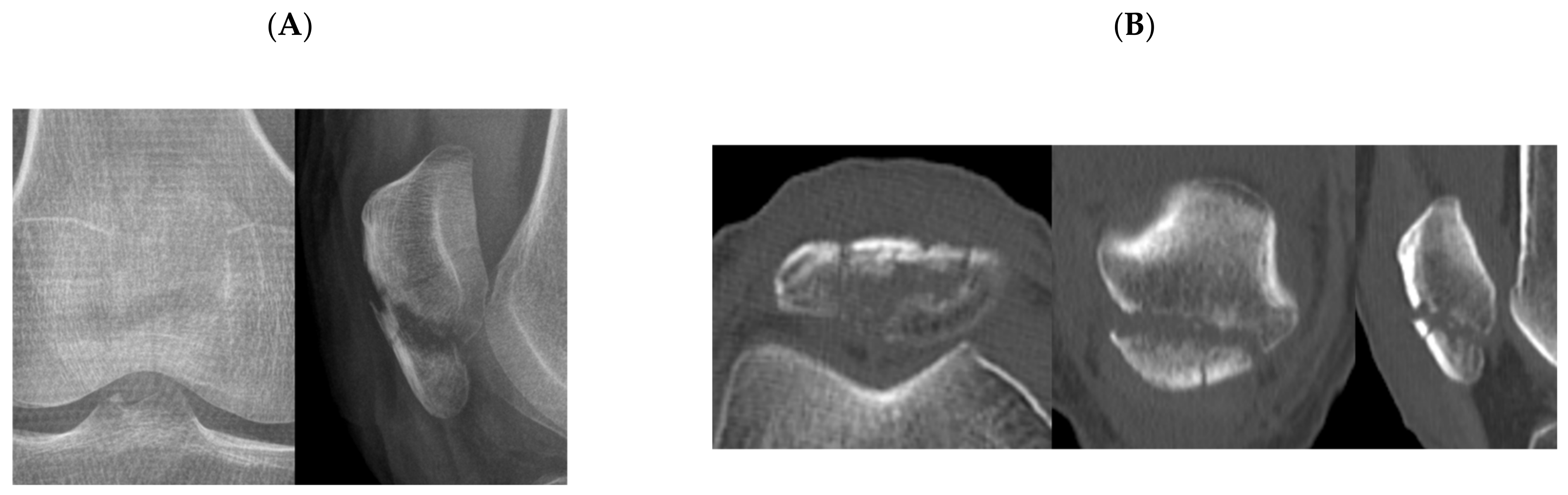 Jcm 10 03256 g003a 550