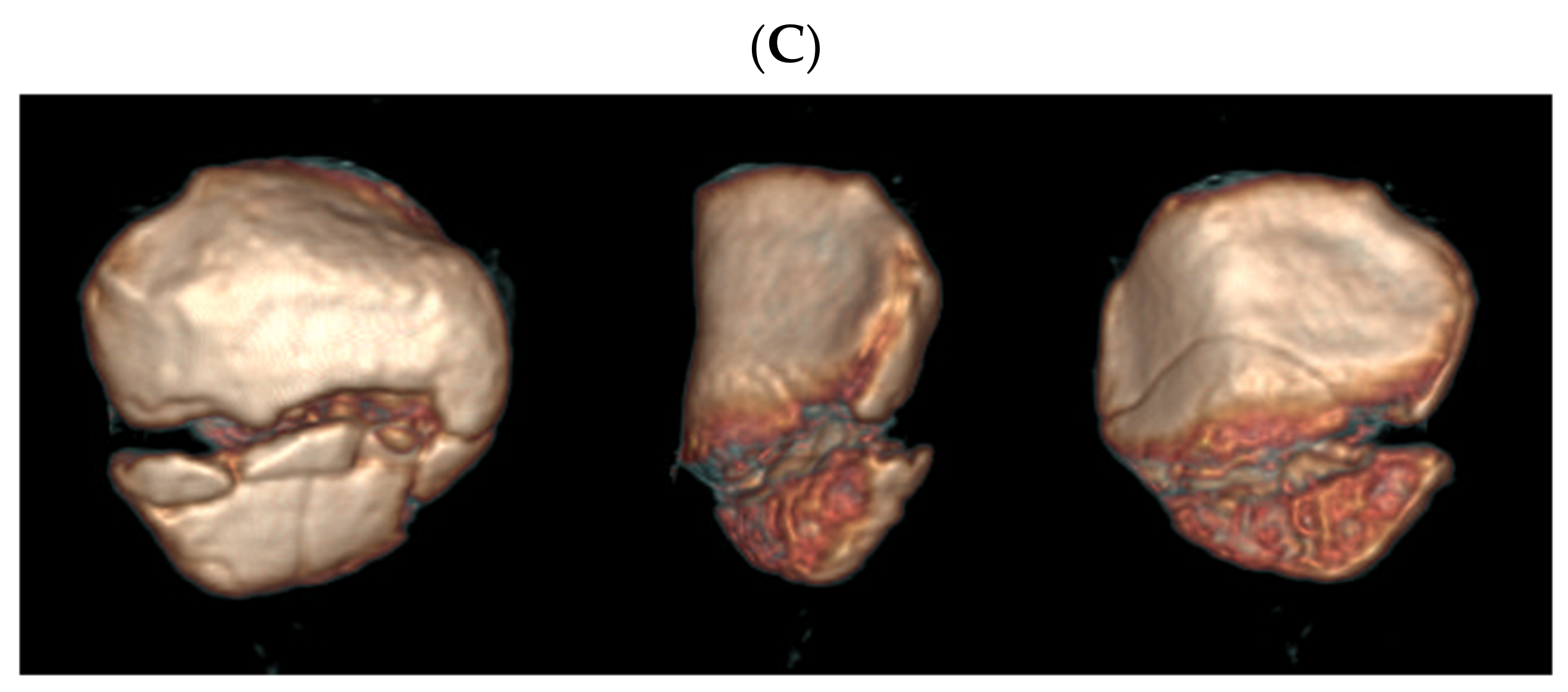 Jcm 10 03256 g003b 550