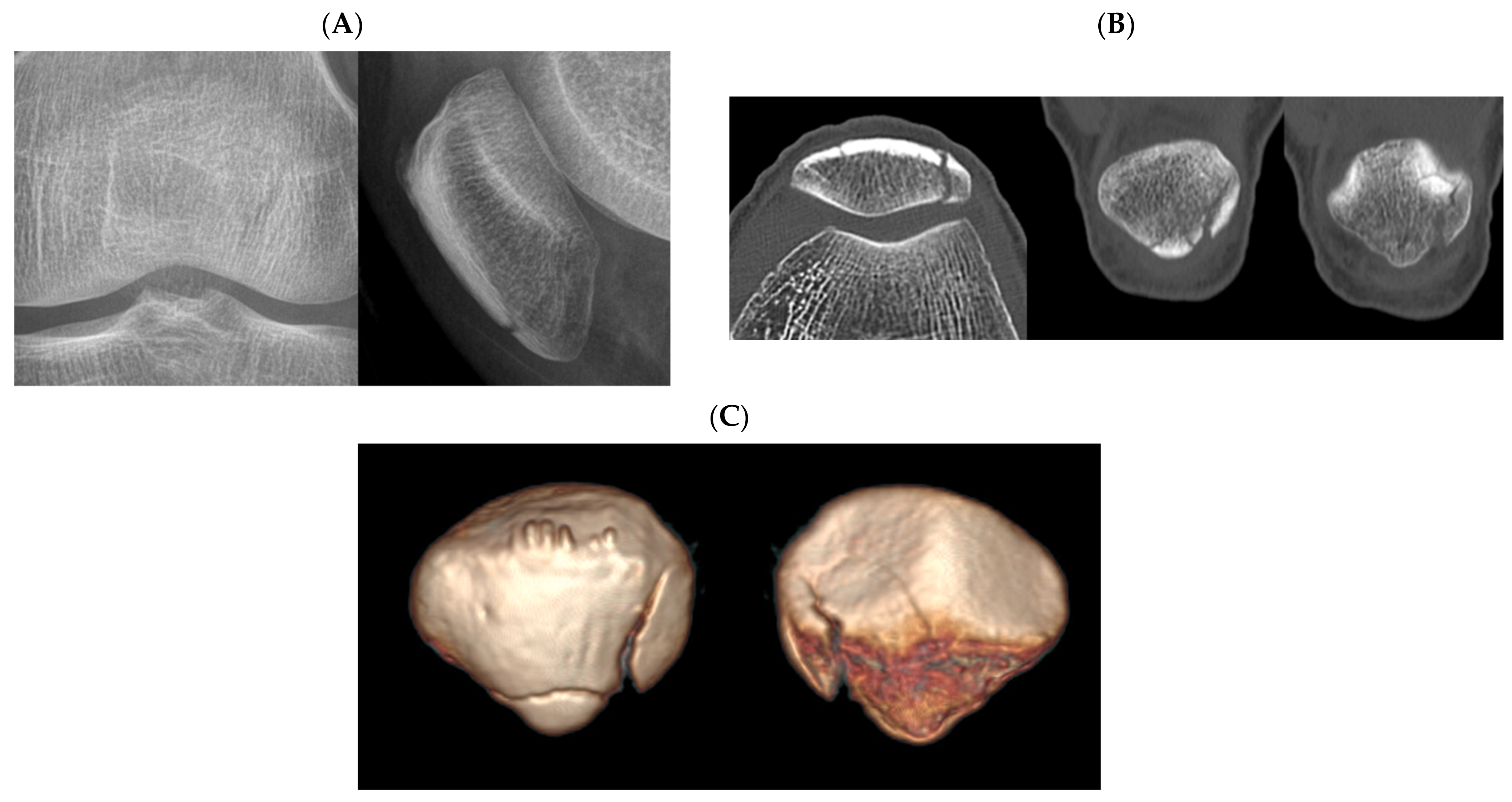 Jcm 10 03256 g004 550