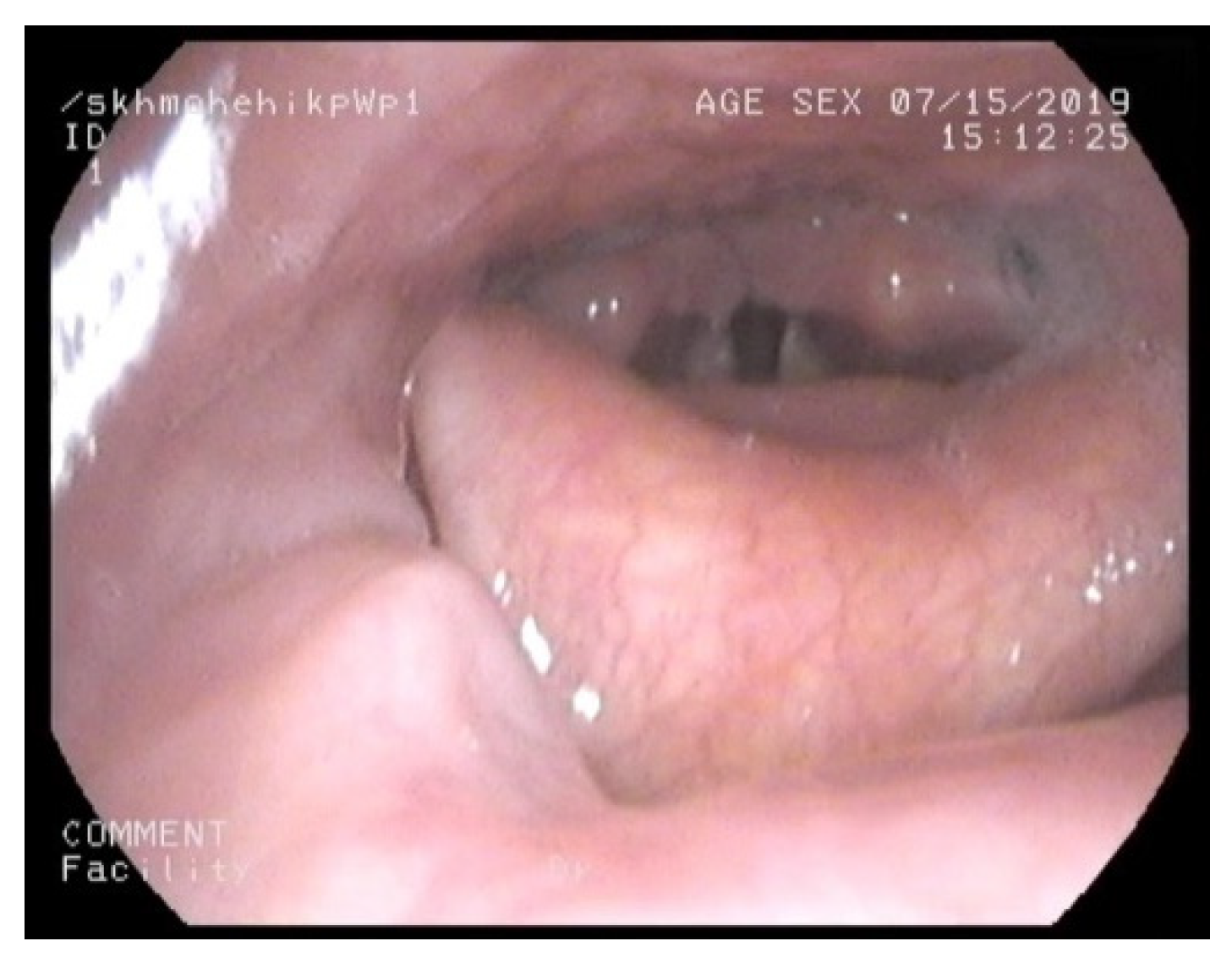 Jcm 10 03275 g004 550