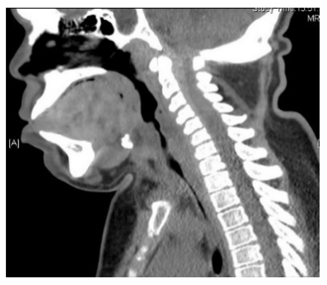 Jcm 10 03275 g006 550