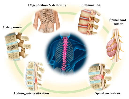 裁断済　脊椎脊髄病学 = PRINCIPLES OF SPINAL DISOR 脊椎脊髄病学 第3版【電子版】 | 医書.jp