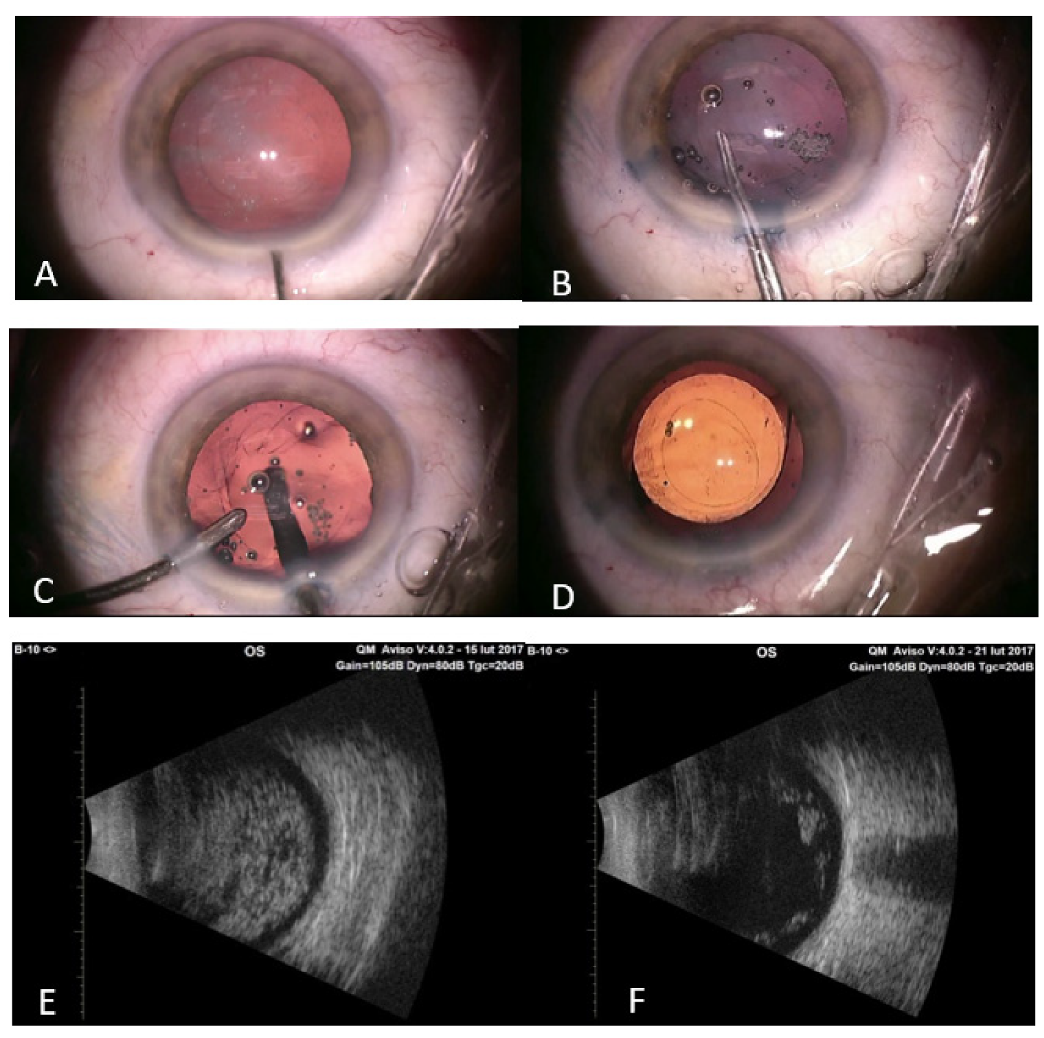 Jcm 10 03338 g002 550